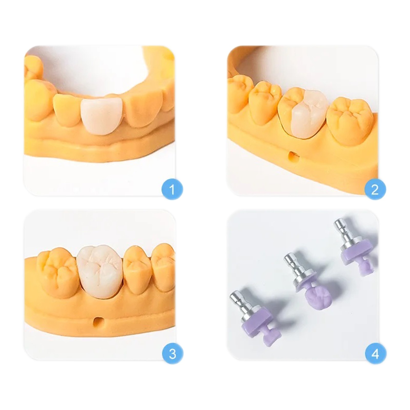 US Dental Lithium Disilicate Emax Chairside CAD/CAM Milling CEREC Inlab Blocks