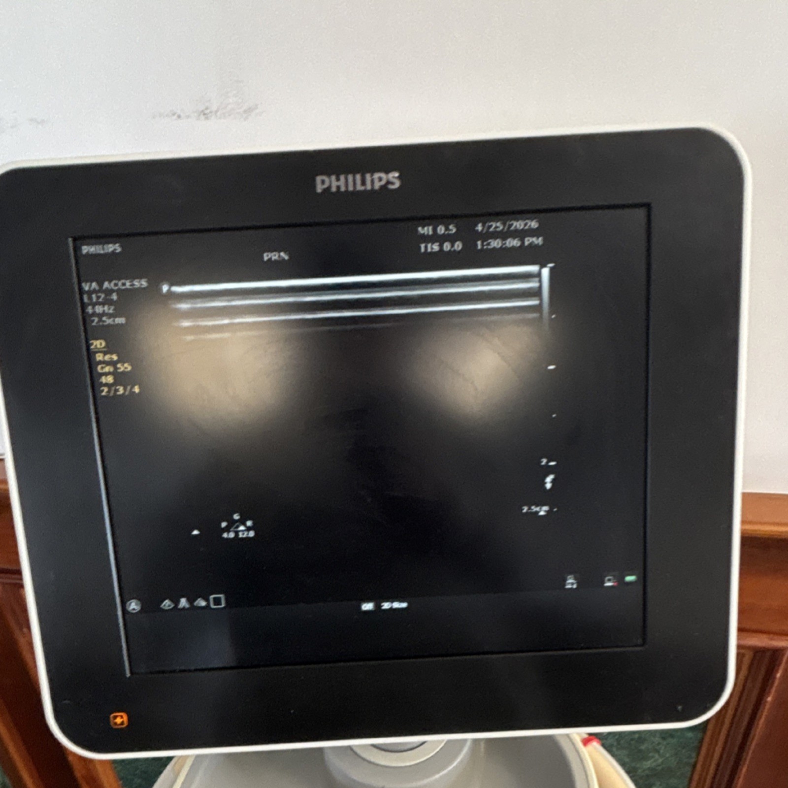 Philips Sparq Cart Mounted Ultrasound Machine Color Doppler with 3 probes