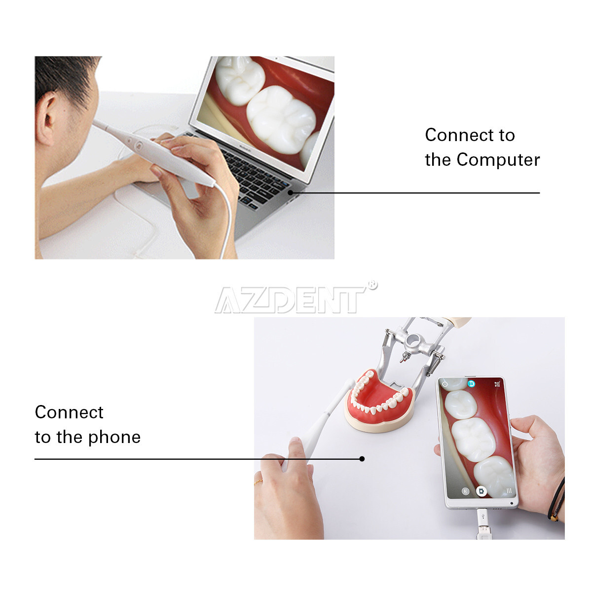 AZDENT Dental Intraoral Camera USB Imaging Intra Oral HD Camera 8 LED light