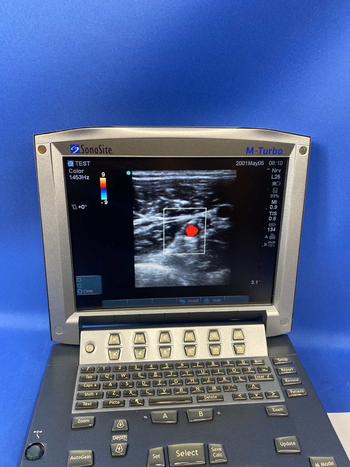 Fujifilm Sonosite L25x/13-6 MHz Ultrasound Transducer M-Turbo Edge Edge II S II