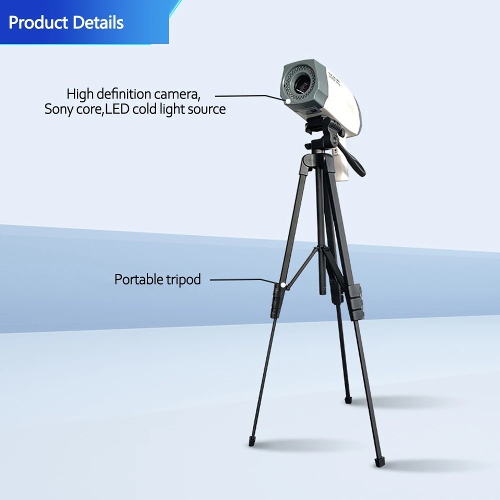 Electronic Digital Colposcope Video HD For Gynecology Colposcopy Imaging System