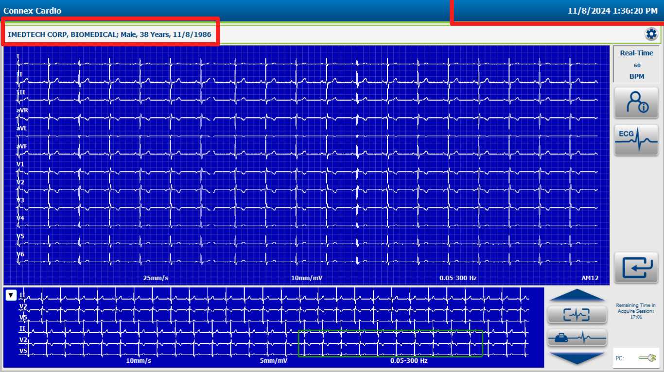 Welch Allyn Diagnostic Cardiology Suite PC ECG with Laptop/ Cadio Connex ECG