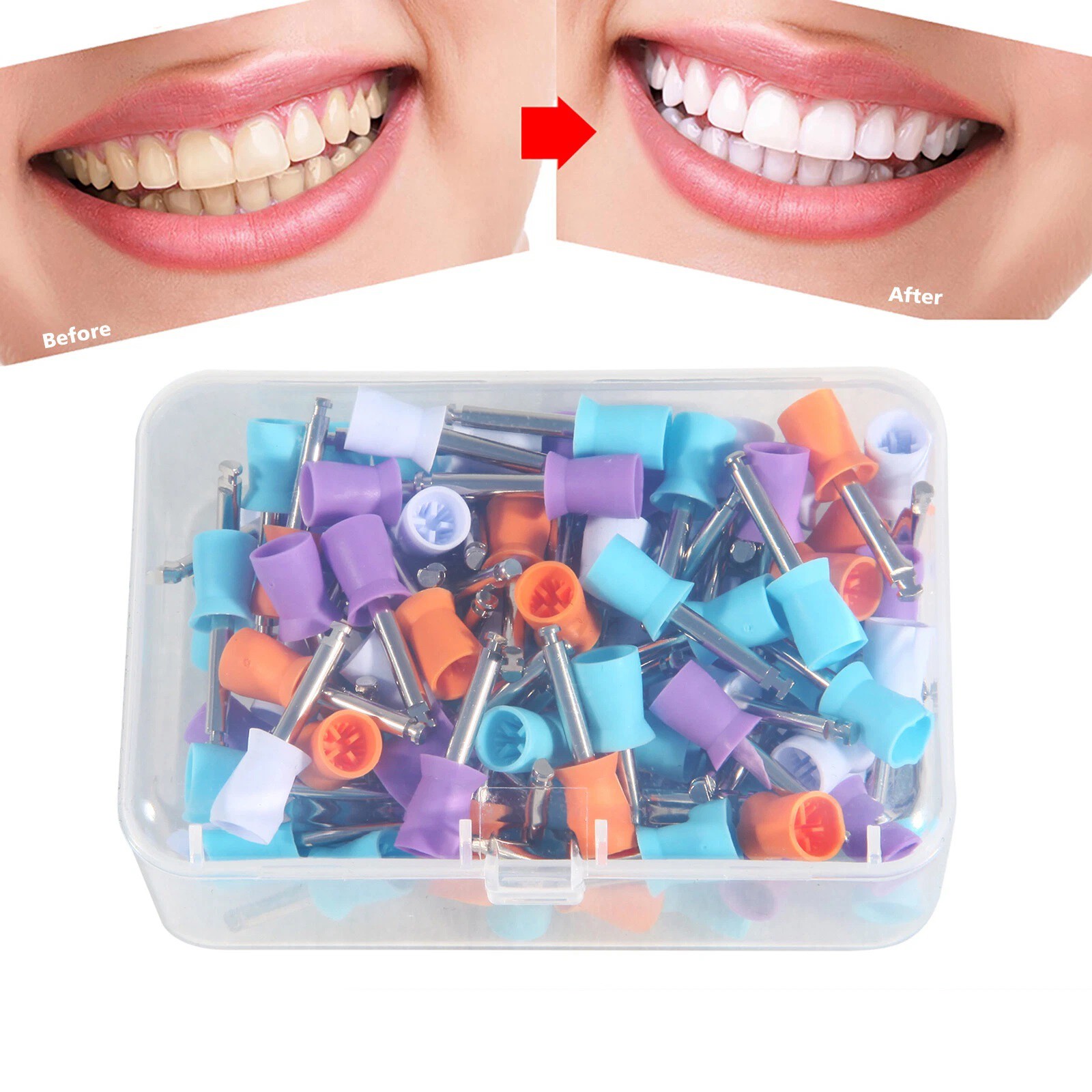 100-1000*Dental Rubber Prophy Tooth Teeth Polish Polishing Cups Latch Type Brush