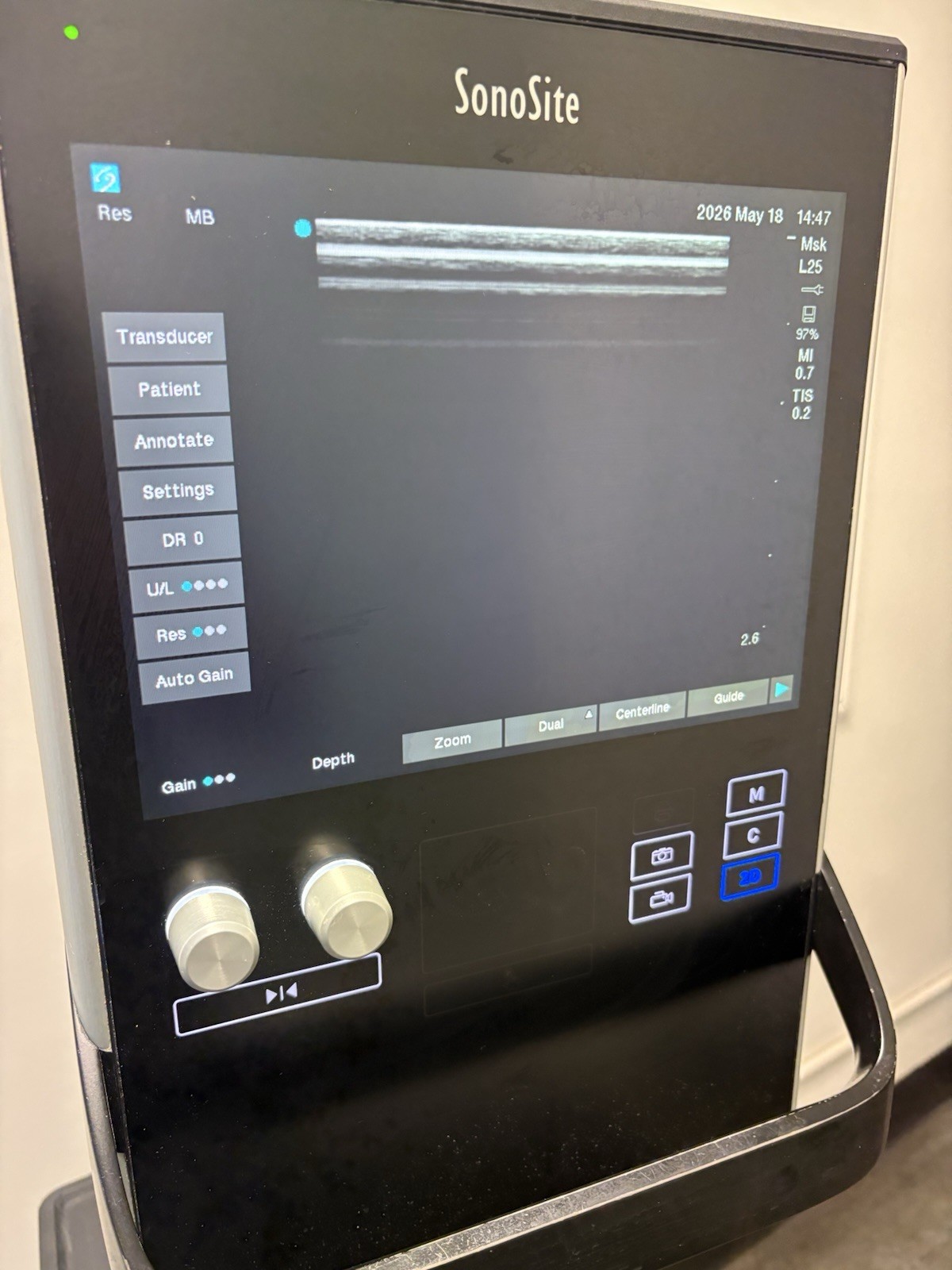 Sonosite SII Total Ultrasound System Ref P20883-12 With Three Probes (PLS READ)