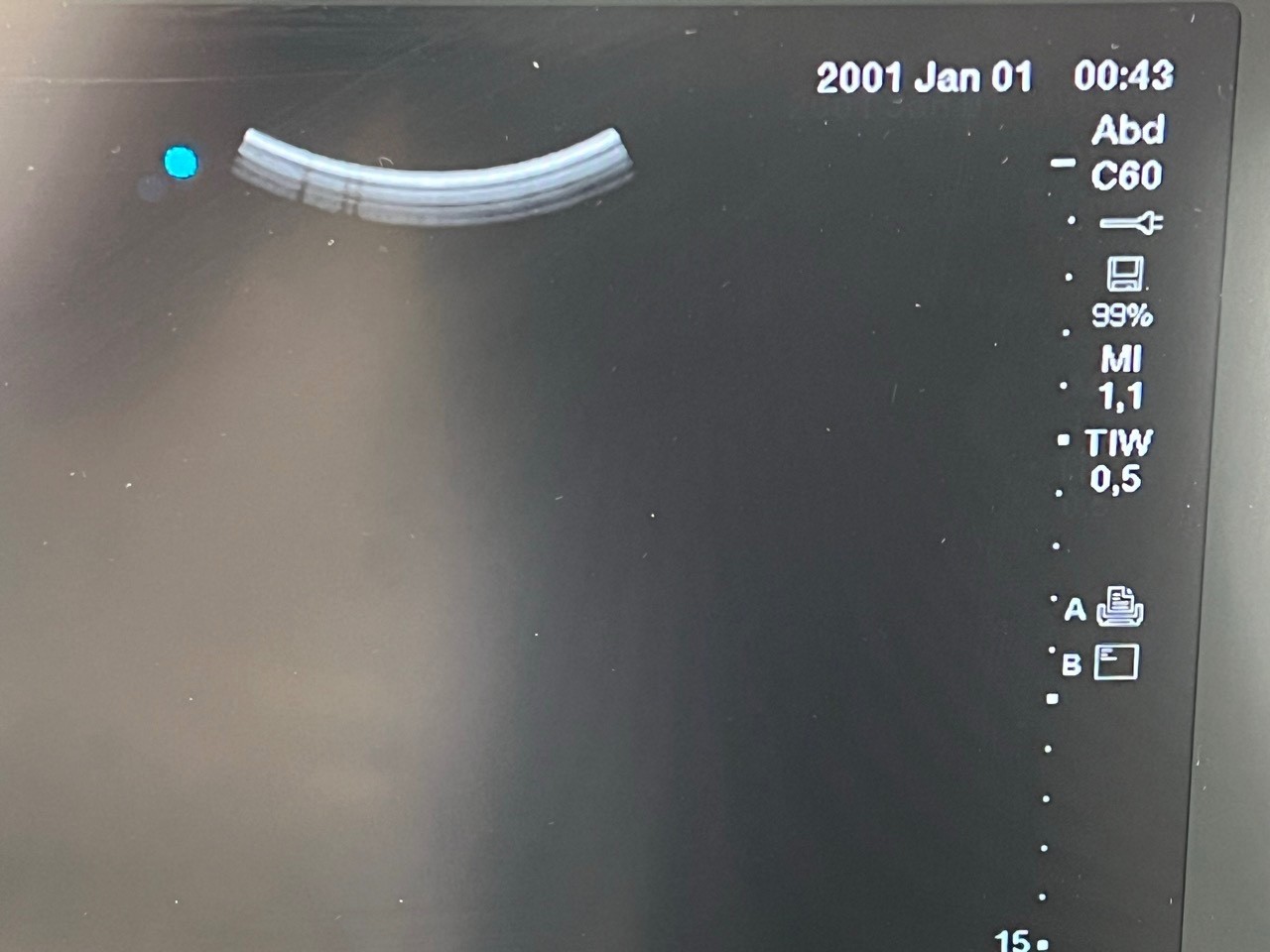 Ultrasound SonoSite Edge II 2017/09 + rP19x, rC60xi, HFL 38xi Transducer(#2335)