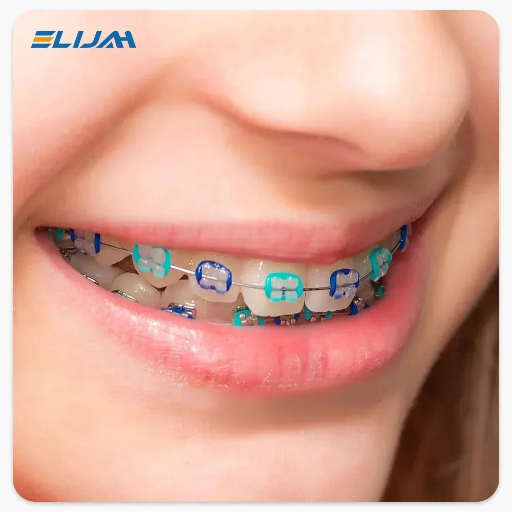 1040pcs Dental Orthodontic Ligature Ties Braces Elastic Rubber Bands Mixed Color