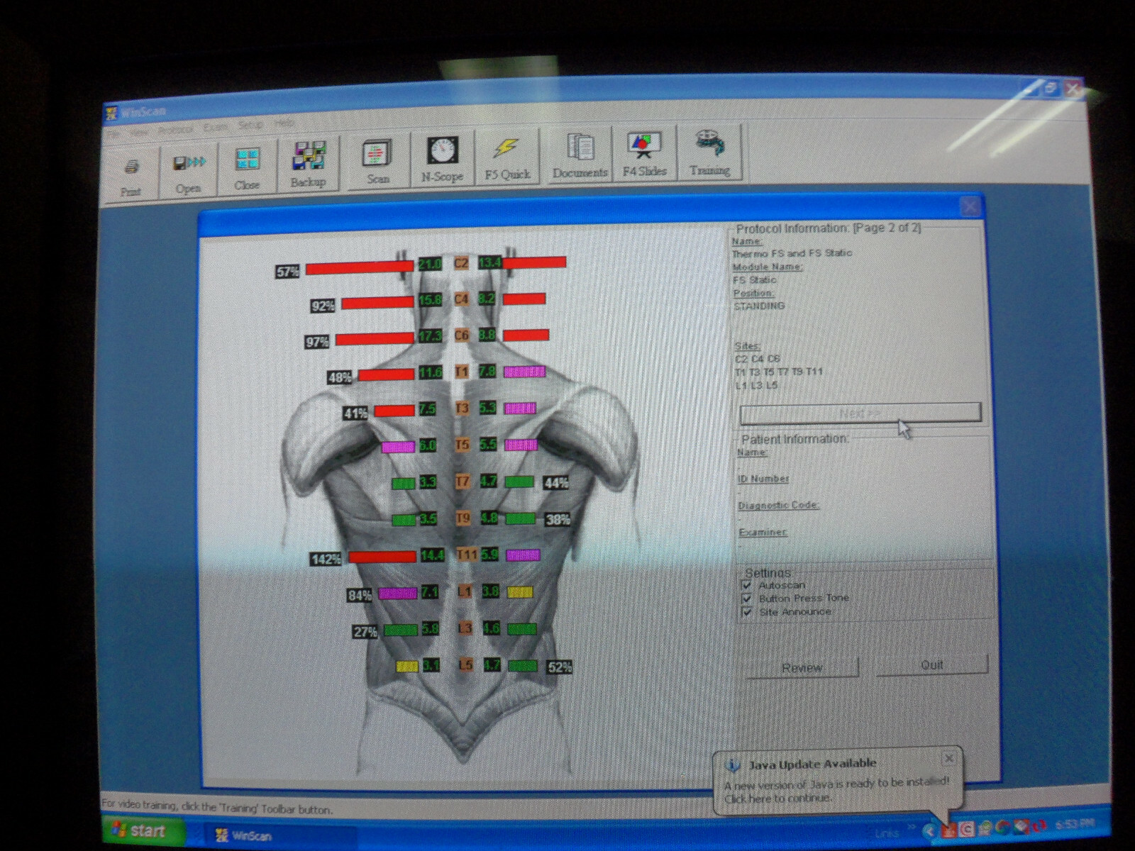 Myovision 8000 Static w/Dynamic sEMG wValidated Laptop Chiropractic Chiropractor