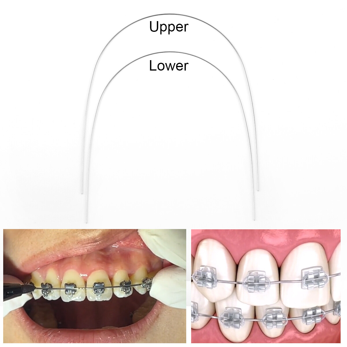 10X AZDENT Dental Orthodontic Super Elastic Niti Arch Wires Round Natural Form