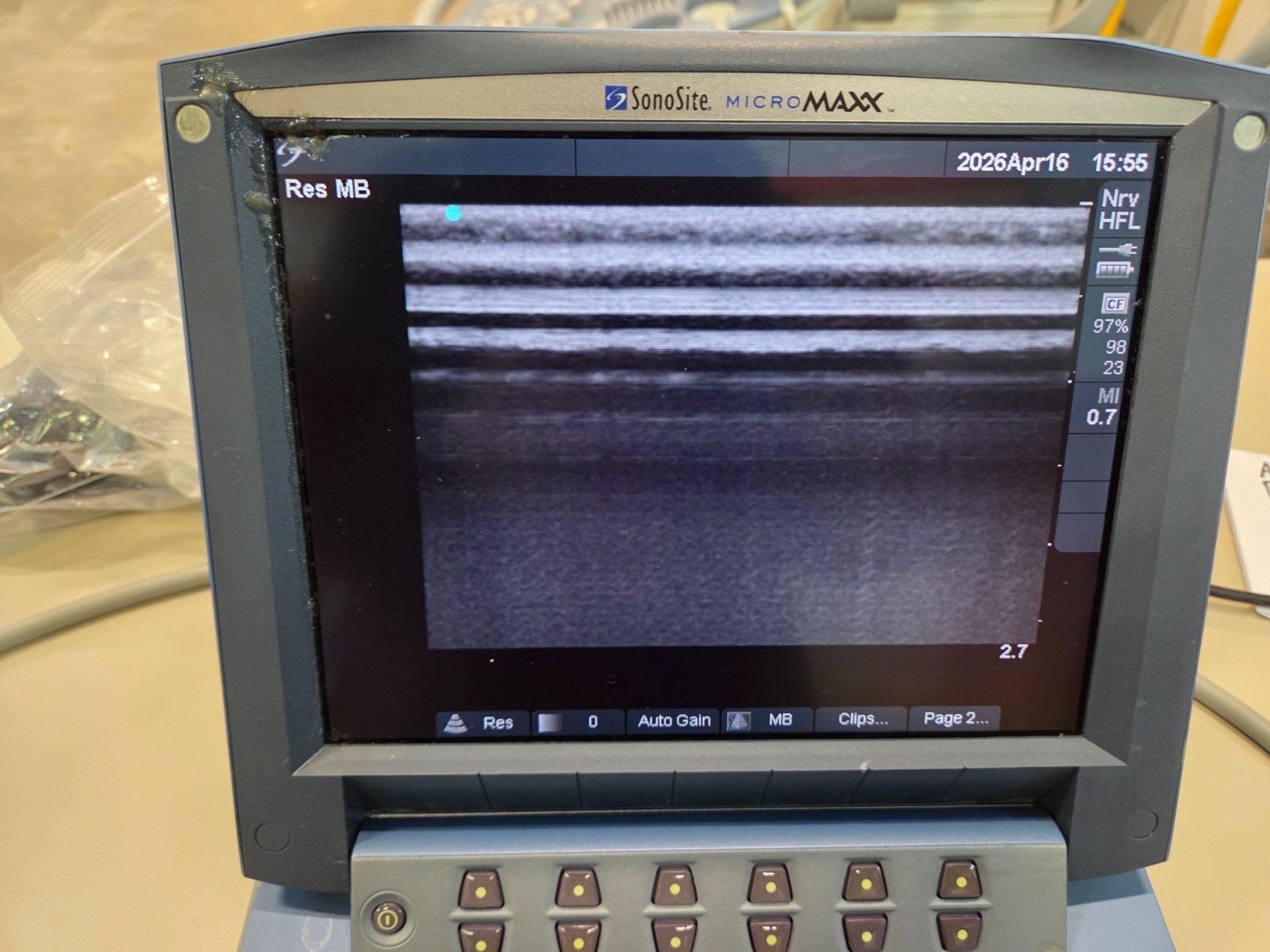 Sonosite Micromaxx Diagnostic Ultrasound System