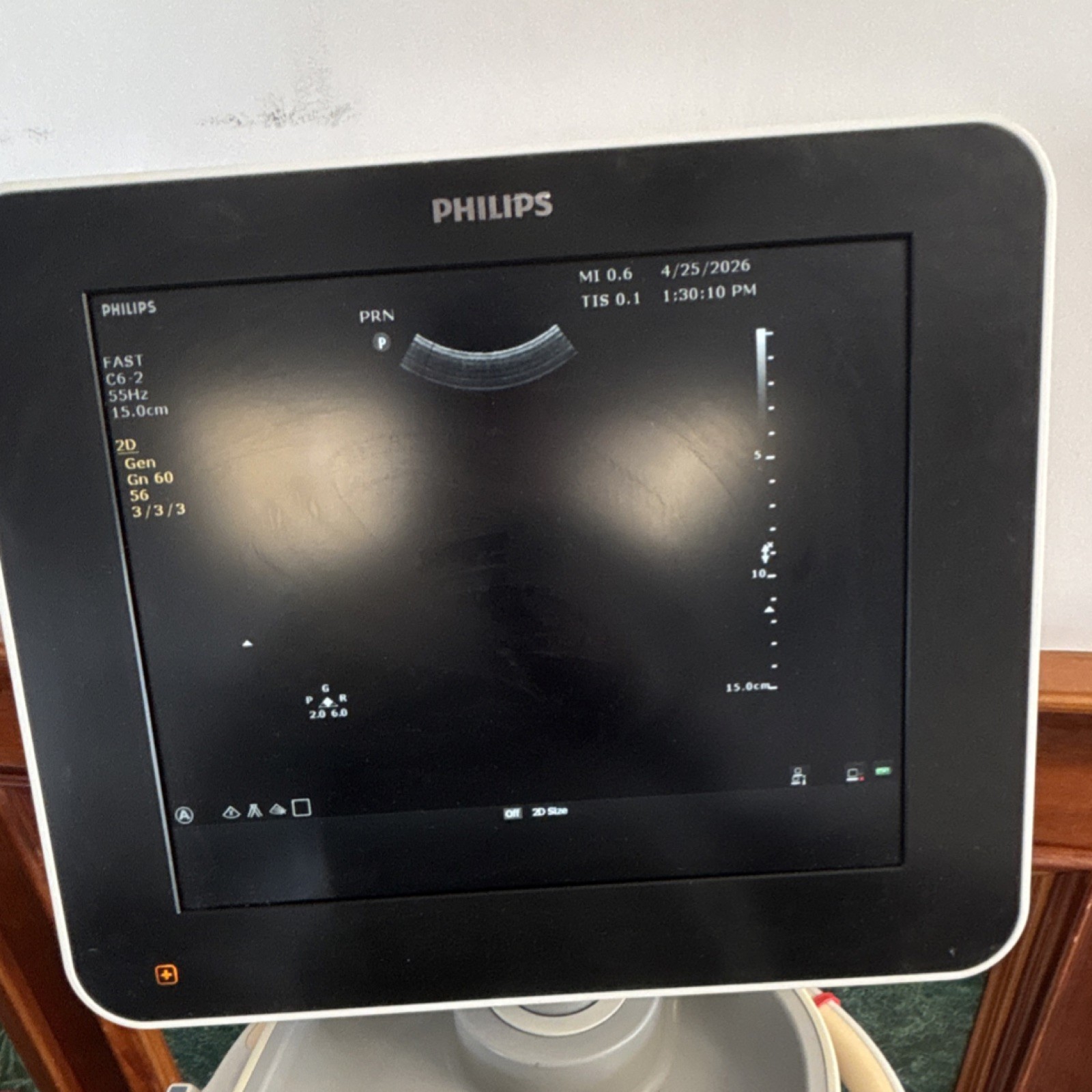 Philips Sparq Cart Mounted Ultrasound Machine Color Doppler with 3 probes
