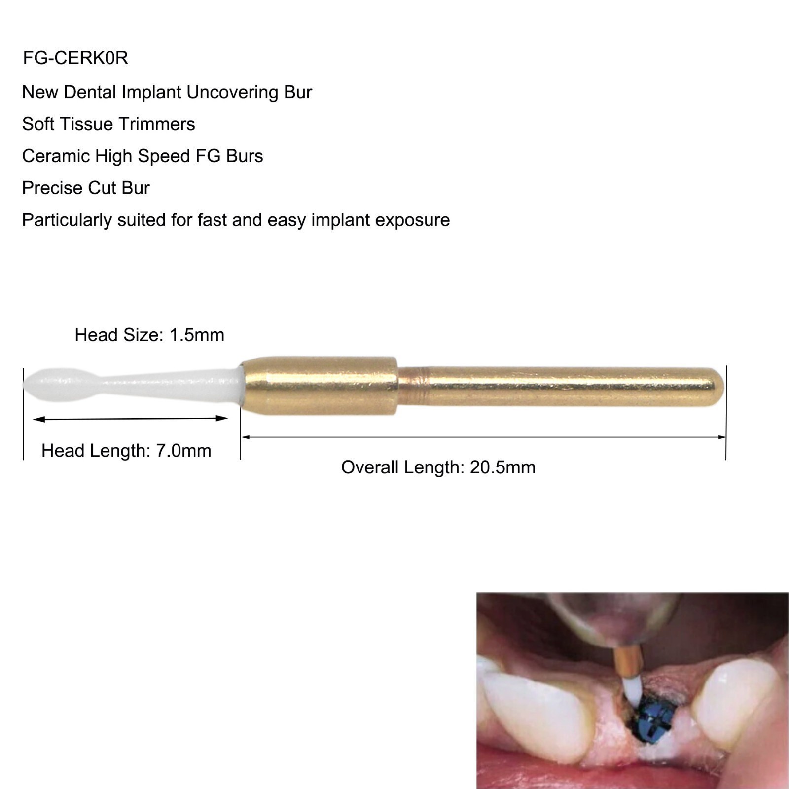 Dental Surgical Ceramic Soft Tissue Trimmer Bur for Gingivectomy 4PCS