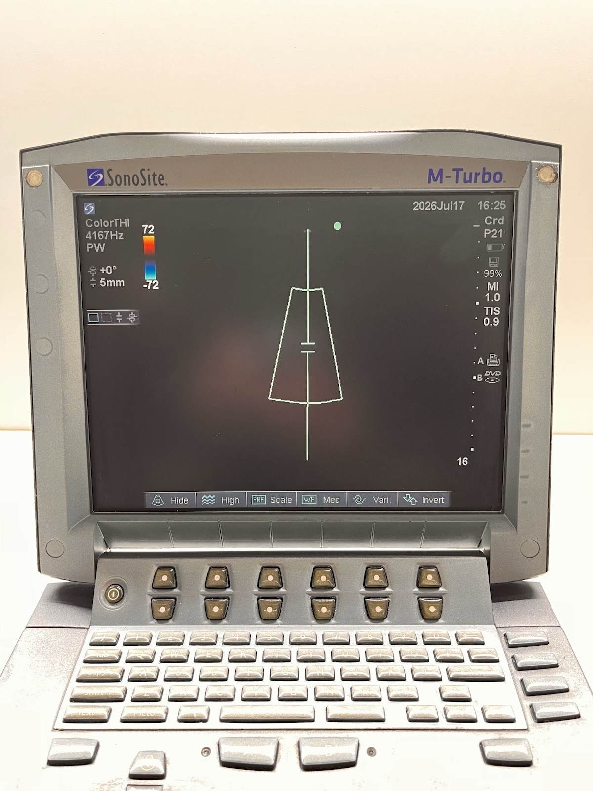 SonoSite M-Turbo Portable Ultrasound System P08189-70w/ P21x/5-1 MHz Transducer