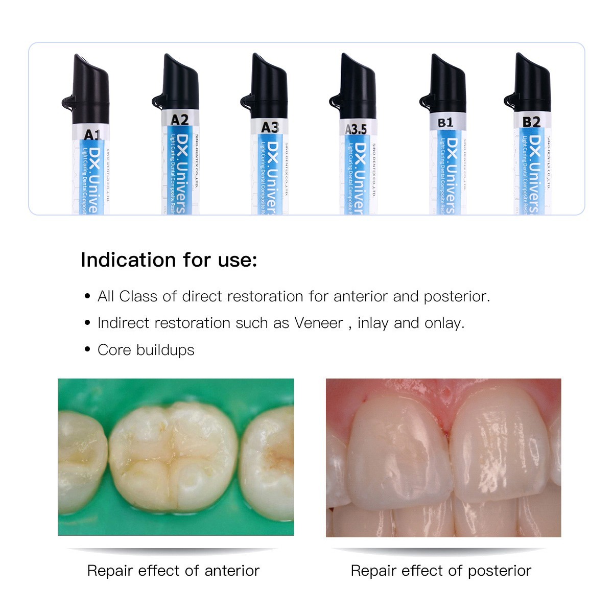 Dentex Dental Universal Composite Resin Light Cure A1/A2/A3/A3.5/B1/B2
