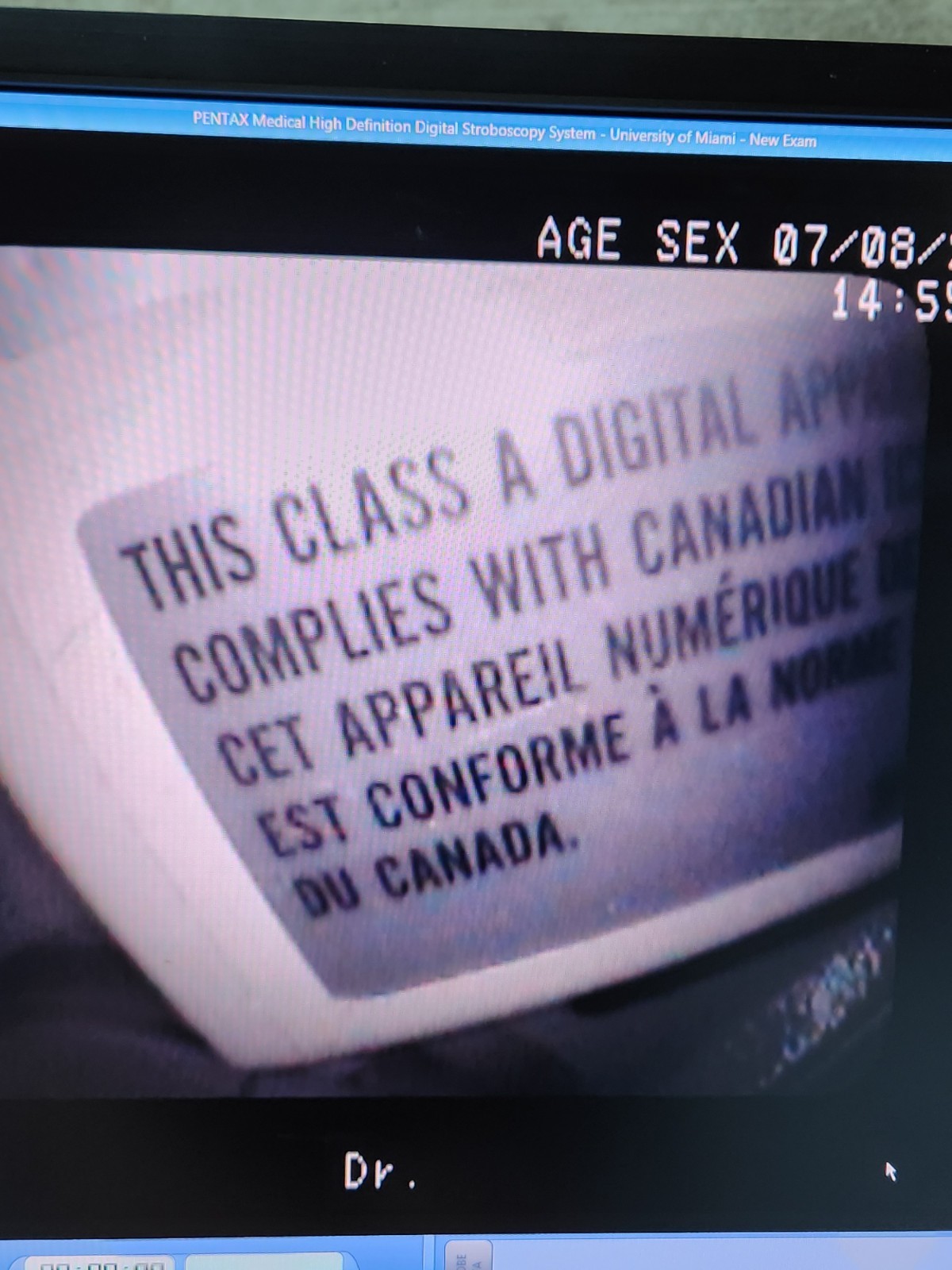 Pentax VNL-1070STK Video Naso Tested