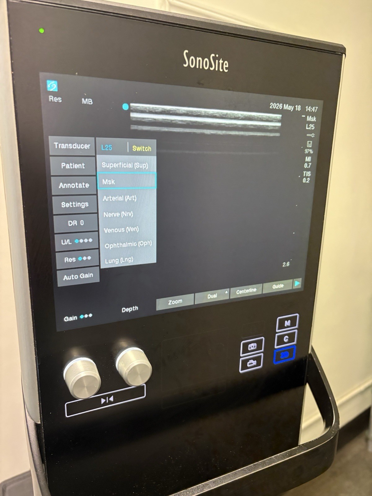 Sonosite SII Total Ultrasound System Ref P20883-12 With Three Probes (PLS READ)