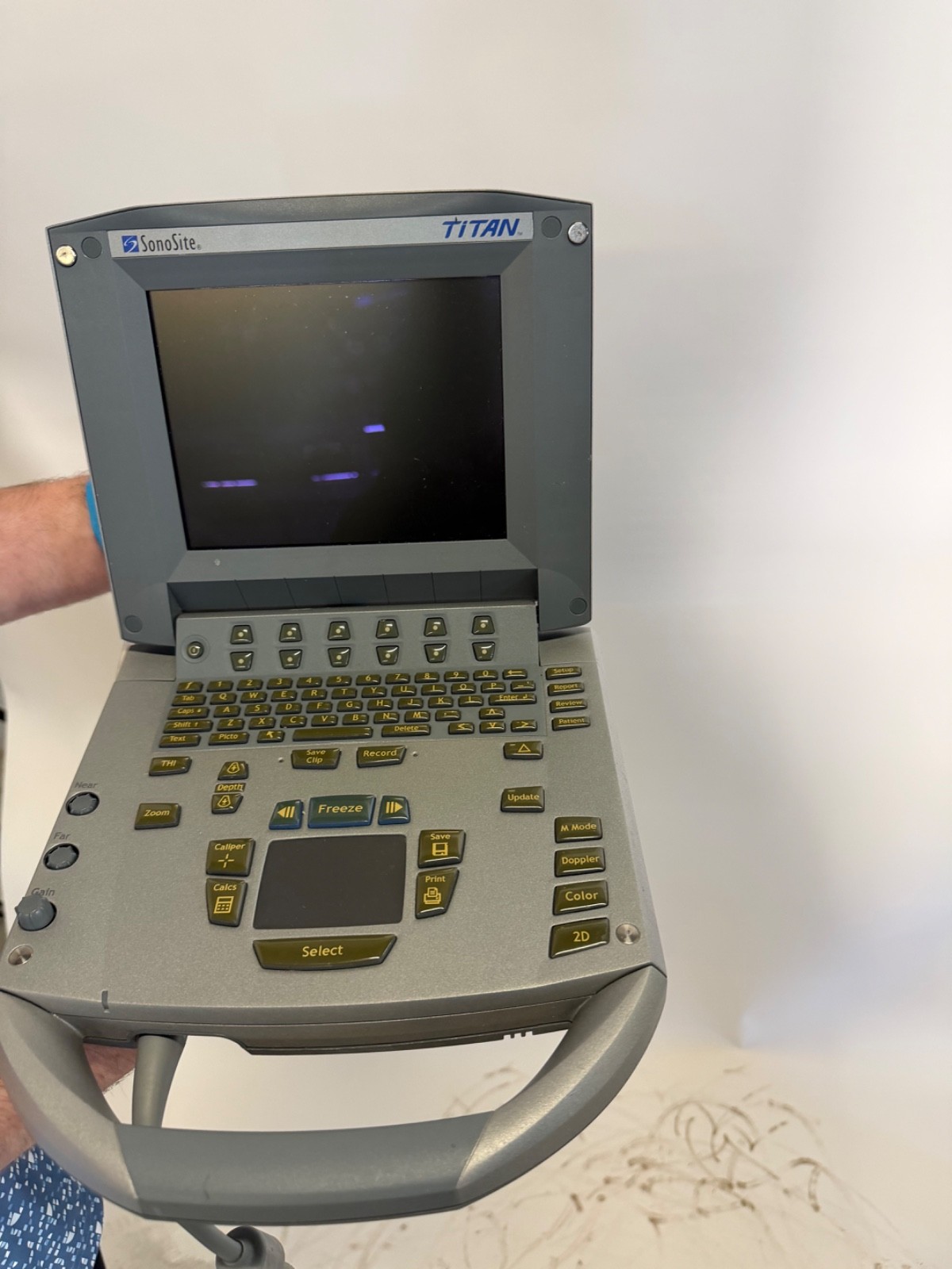 SonoSite Titan Portable Ultrasound System Only Monitor