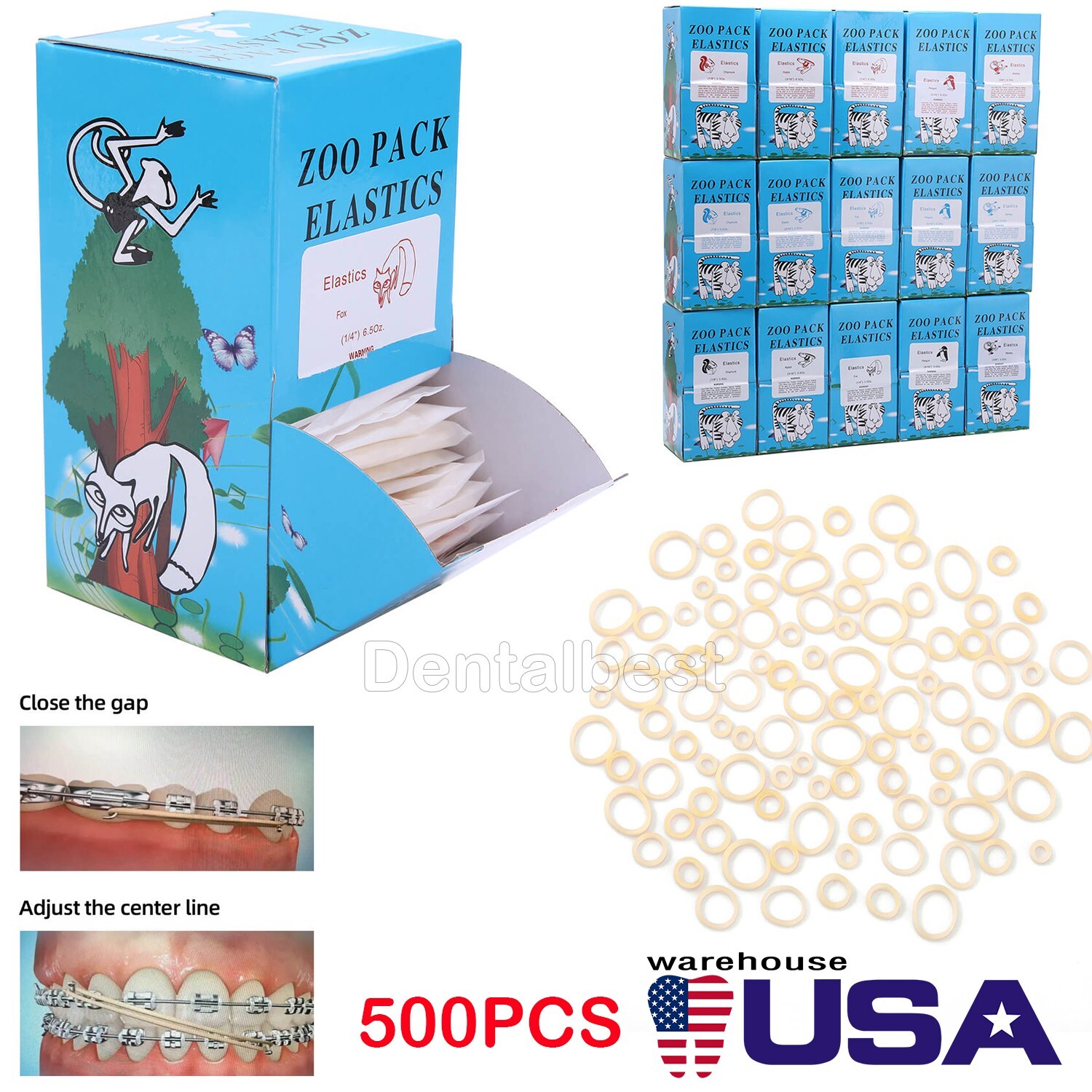 AZDENT Bandas Elásticas Ortodoncia Látex Elásticos Dental Elastics Rubber Bands