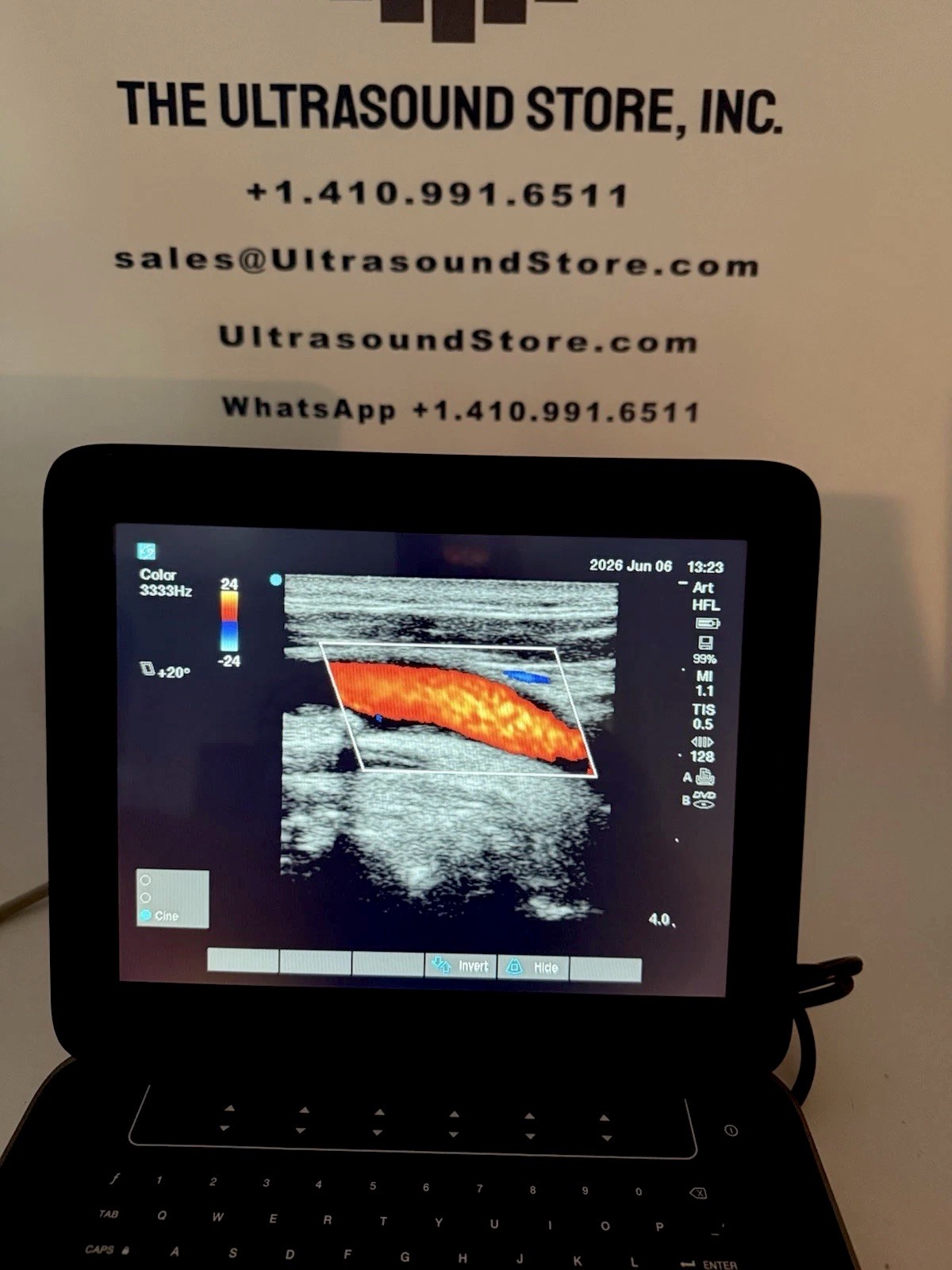 SonoSite Edge II Ultrasound | Factory Refurb | Probe Choice I 1-Year Warranty