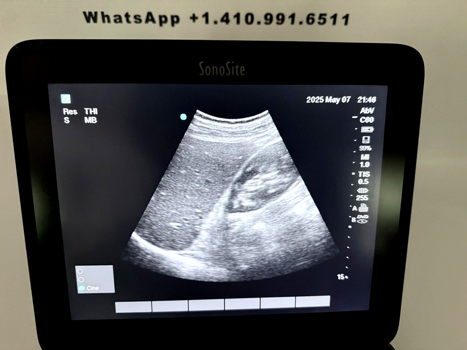 SonoSite Edge II Vet Ultrasound Linear Rectal, Convex & Linear. 1yr Warranty!