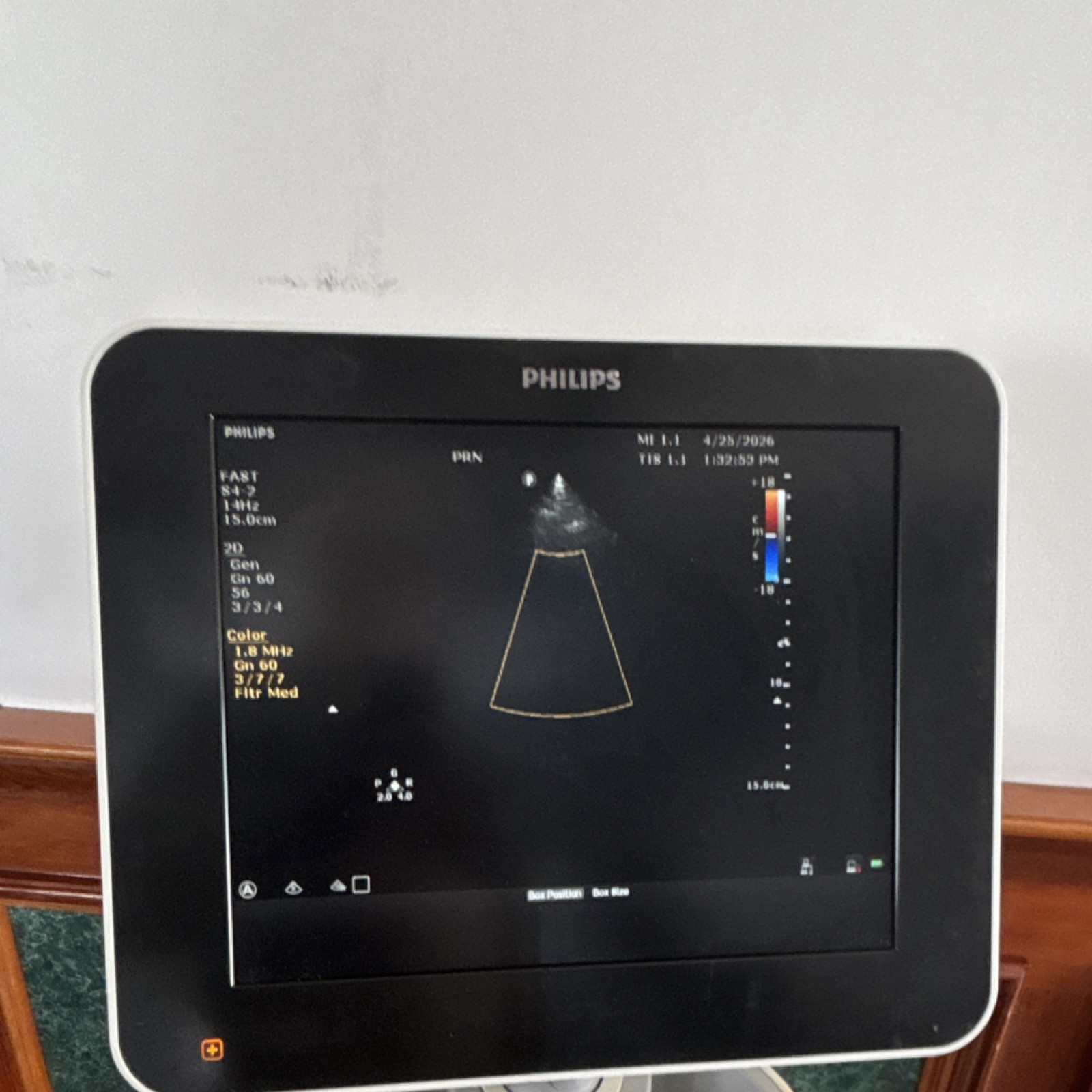 Philips Sparq Cart Mounted Ultrasound Machine Color Doppler with 3 probes