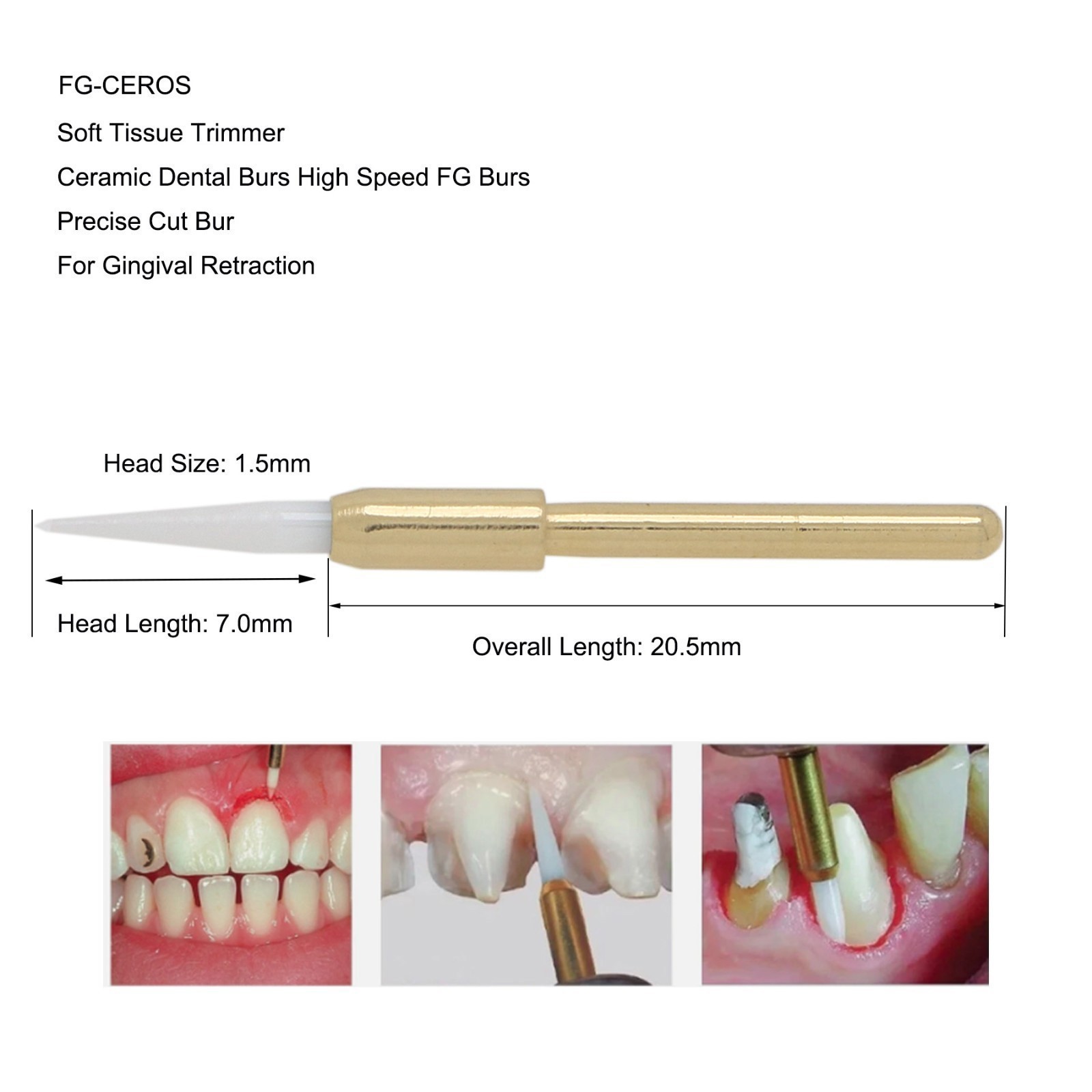 Dental Surgical Ceramic Soft Tissue Trimmer Bur for Gingivectomy 4PCS