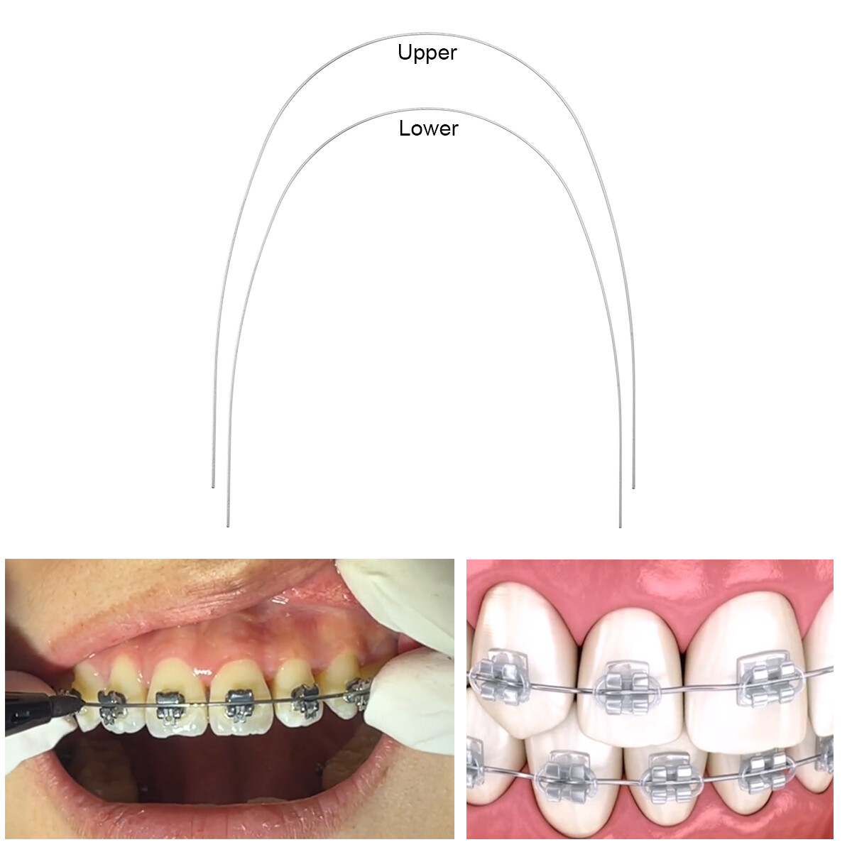 AZDENT Dental Ortho Super Elastic Rectangular Arch Wire Niti Ovoid upper/Lower
