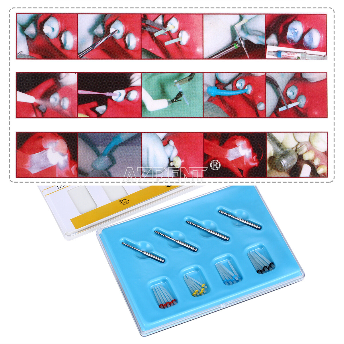 5 Packs Dental High-intensity AAA Fiber Posts Resin Screw Thread Glass 4 Drills