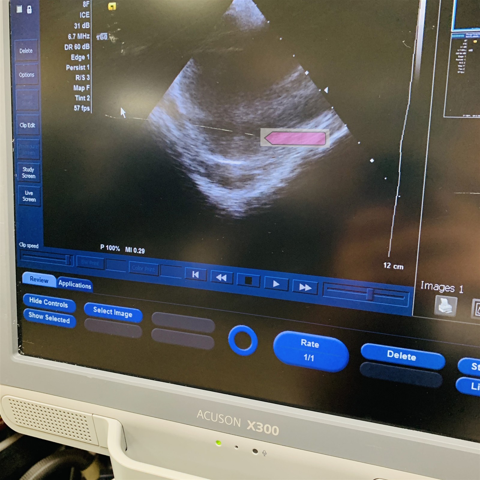 Siemens Accuson X300 Premium *Mfg 2012* Cardiac/OB Imaging Ultrasound 10566144