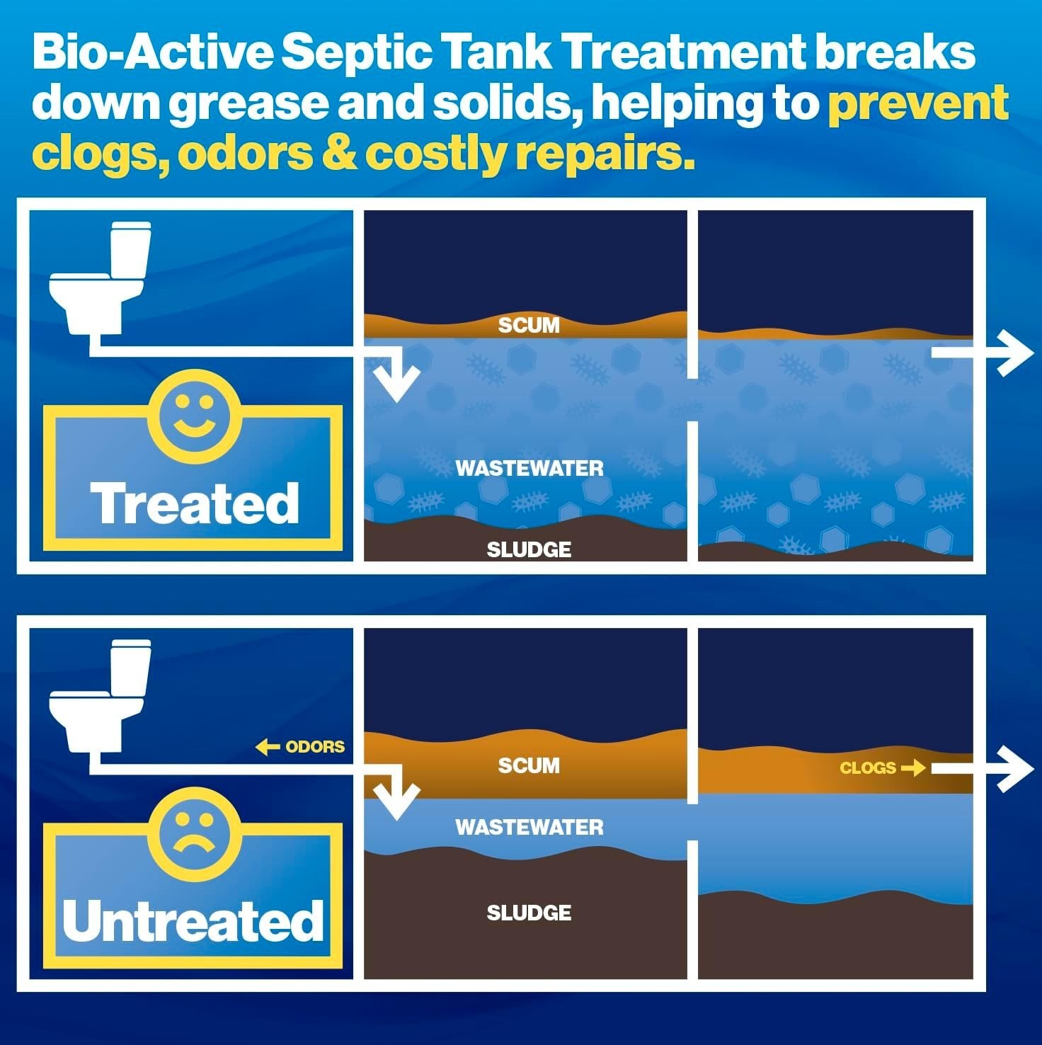 Walex Bio-Active Septic Tank Treatment – 1 Year Supply, Odor Control Packets