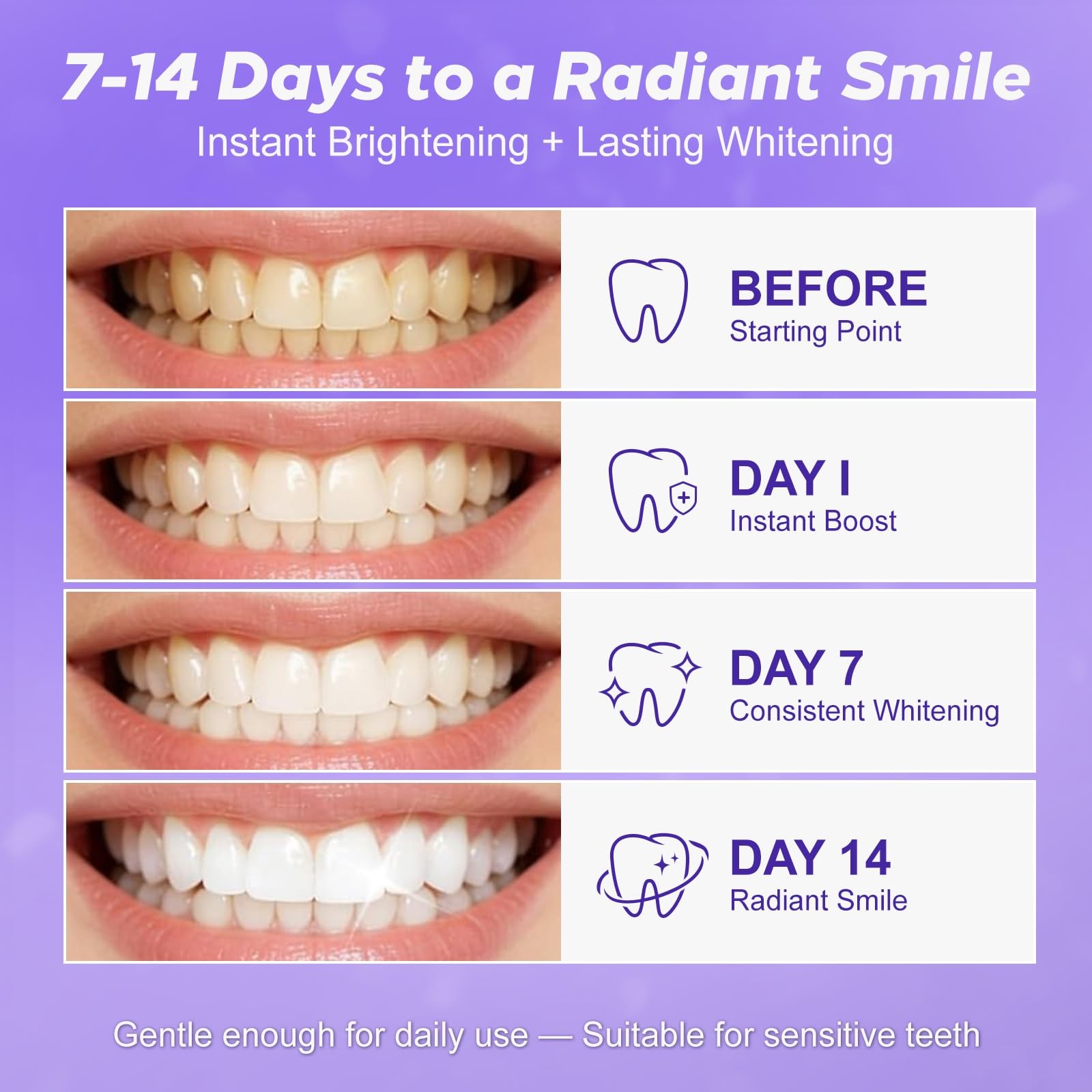 Purple Teeth Whitening Strips 28 Count – 14 Days 1 (Pack of 28),