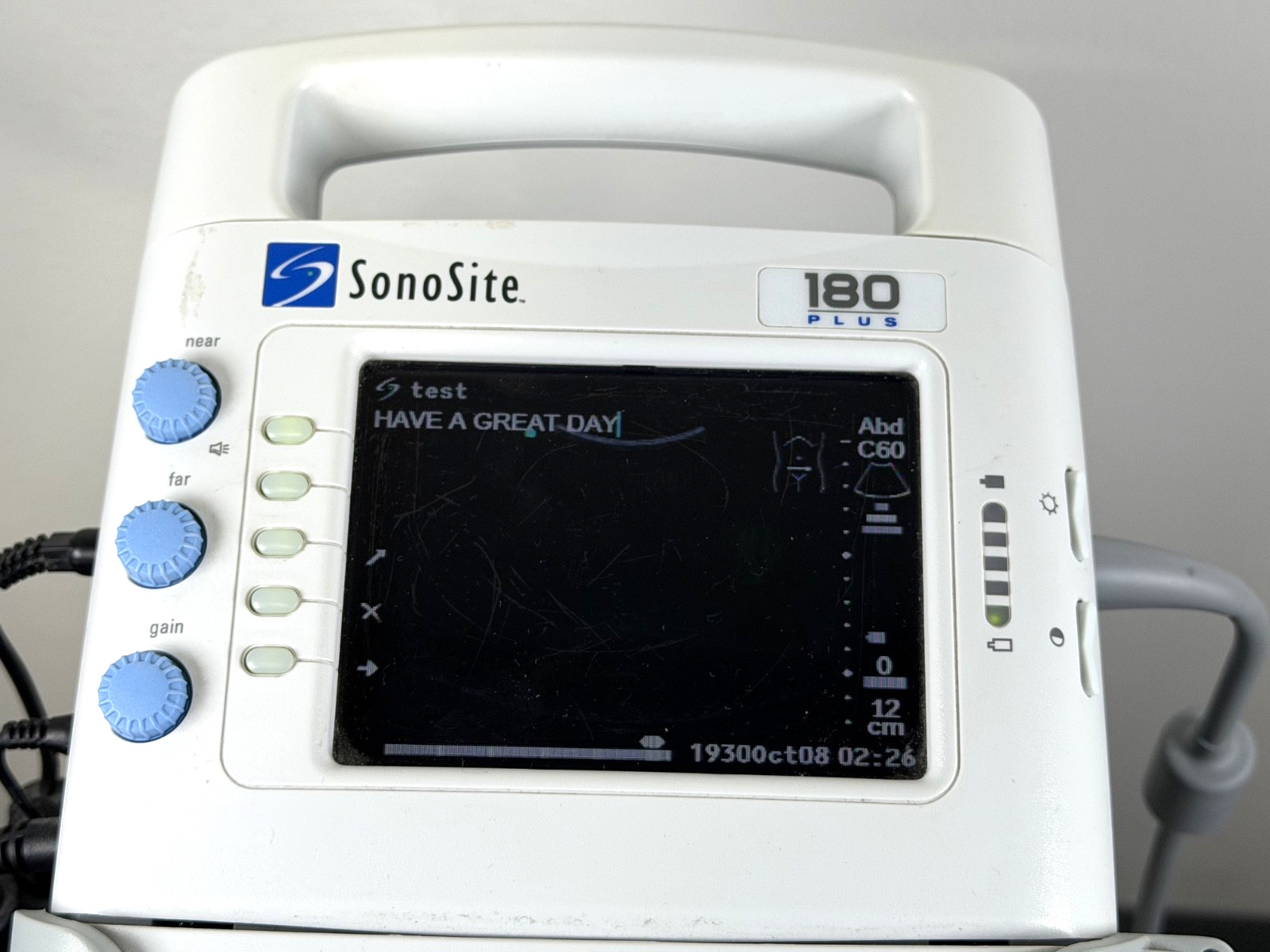 Sonosite 180 Plus Portable Ultrasound Machine w 2 probes