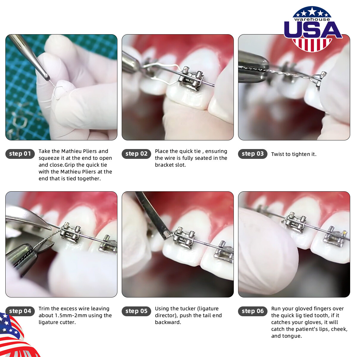 100pcs/Pack Dental Ortho Preformed Ligature Wire Ligature Ties Long Short