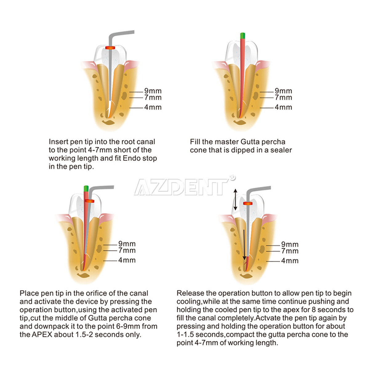 Dental Cordless Gutta Percha Obturation System Endo Heated Pen Root/Hand Plugger