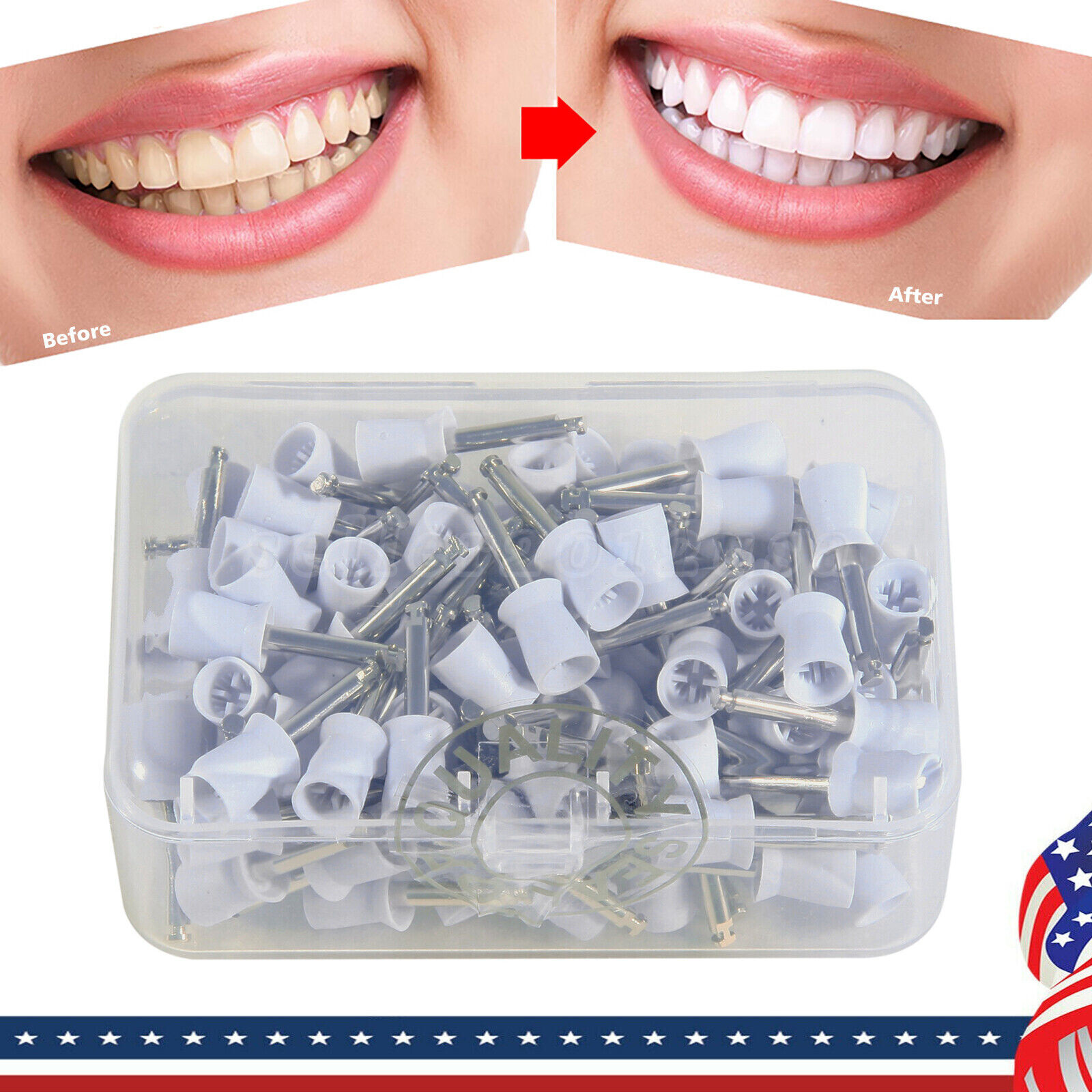 100pcs Dental Tooth Prophy Polishing Cups Latch Type Rubber Polish Polisher US
