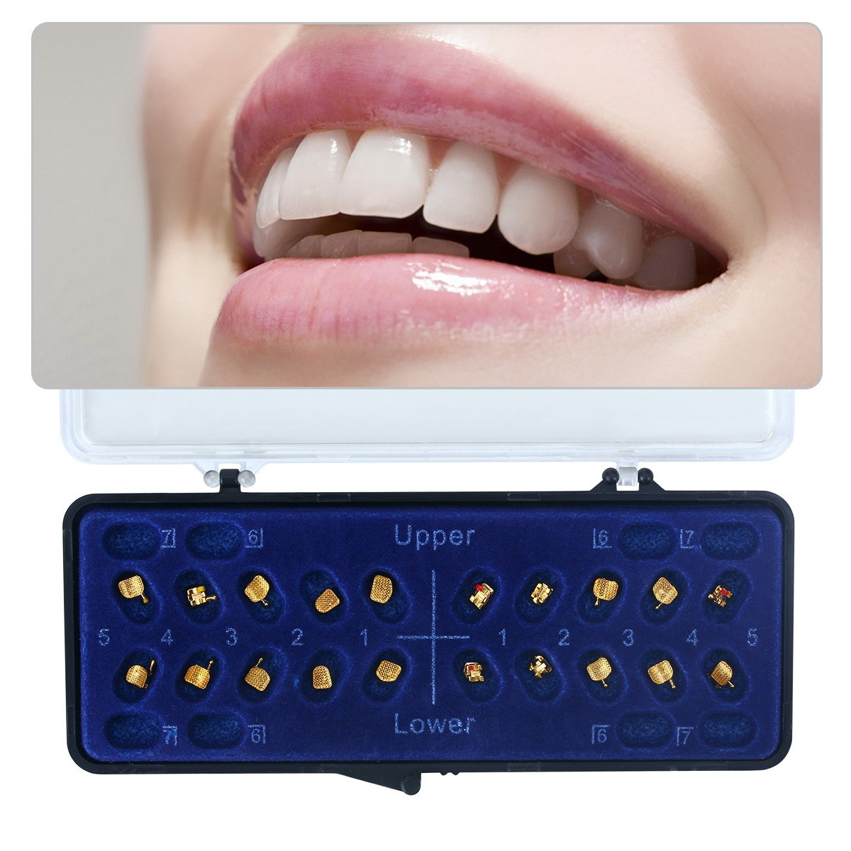 Dental Orthodontic Gold Brackets Mini Roth 022 Hooks 345 Brace AZDENT