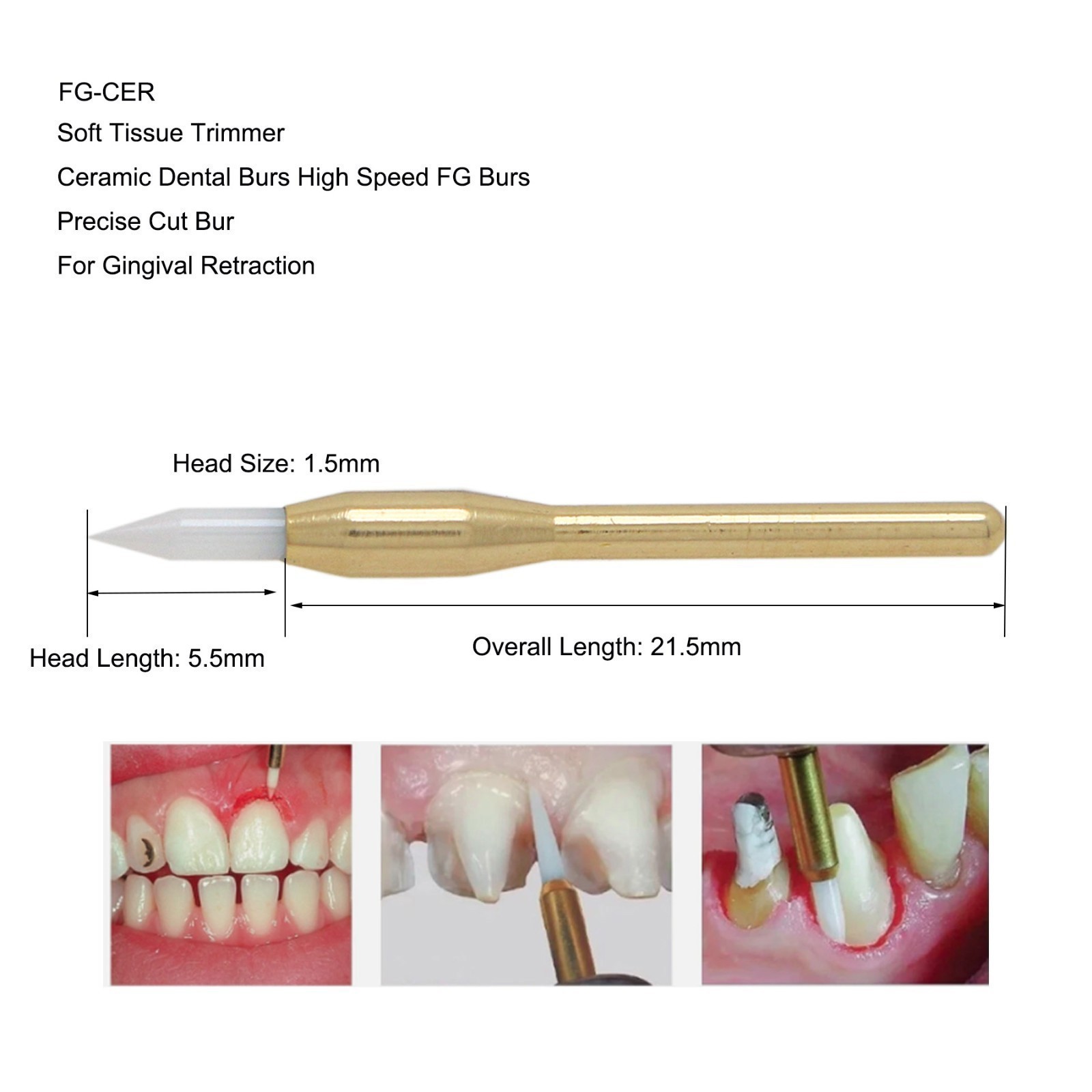 Dental Surgical Ceramic Soft Tissue Trimmer Bur for Gingivectomy 4PCS
