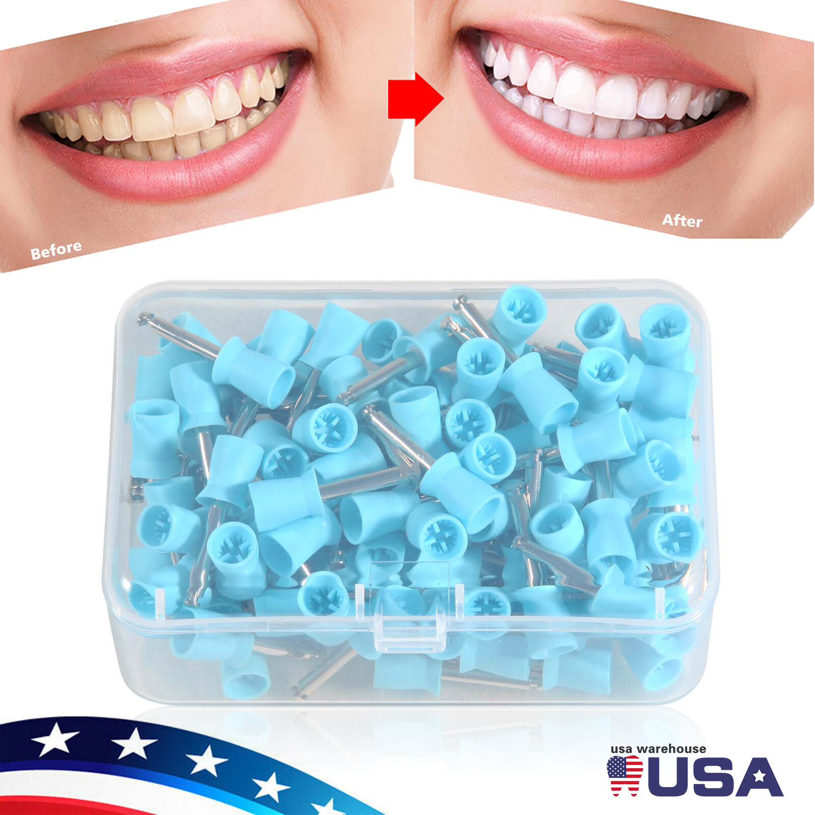 100 Pcs Dental Rubber Prophy Teeth Polish Polishing Cups Latch Type Brushes blue