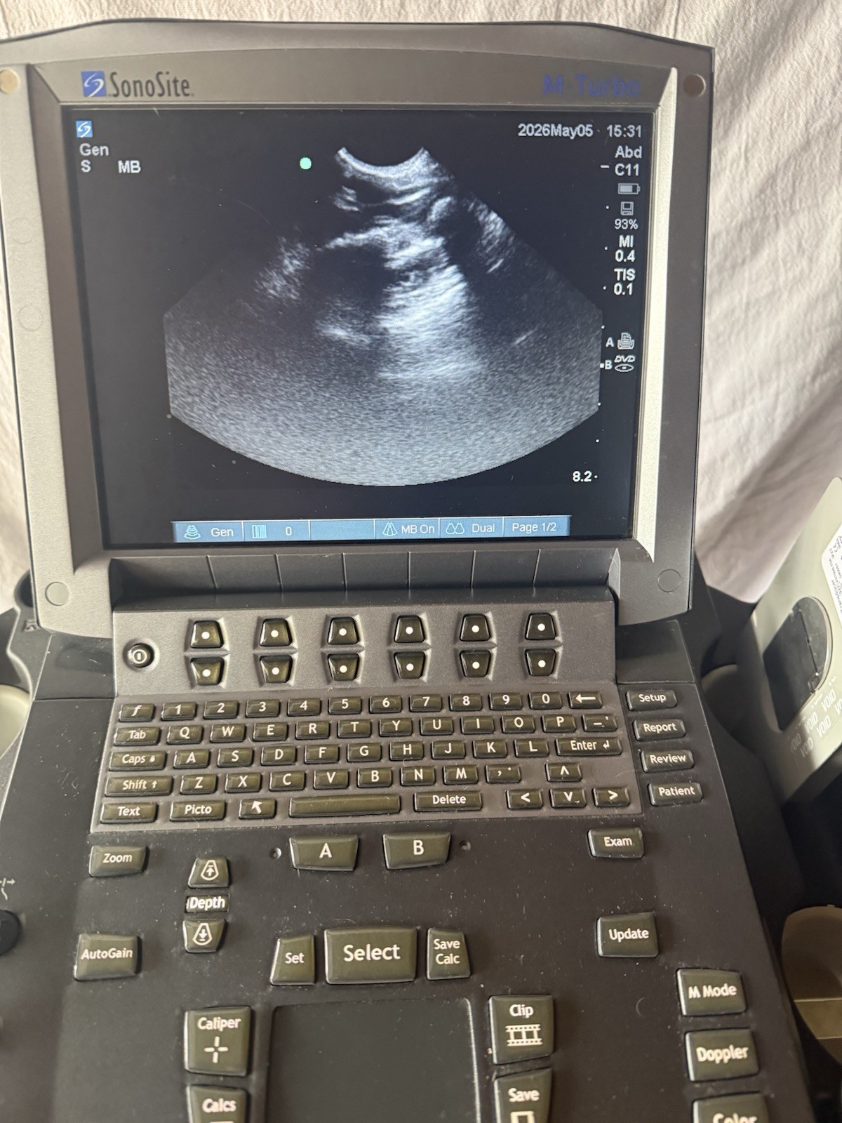 SonoSite M-turbo Portable Vet Ultrasound w/ C11x & P21x Transducer Probe