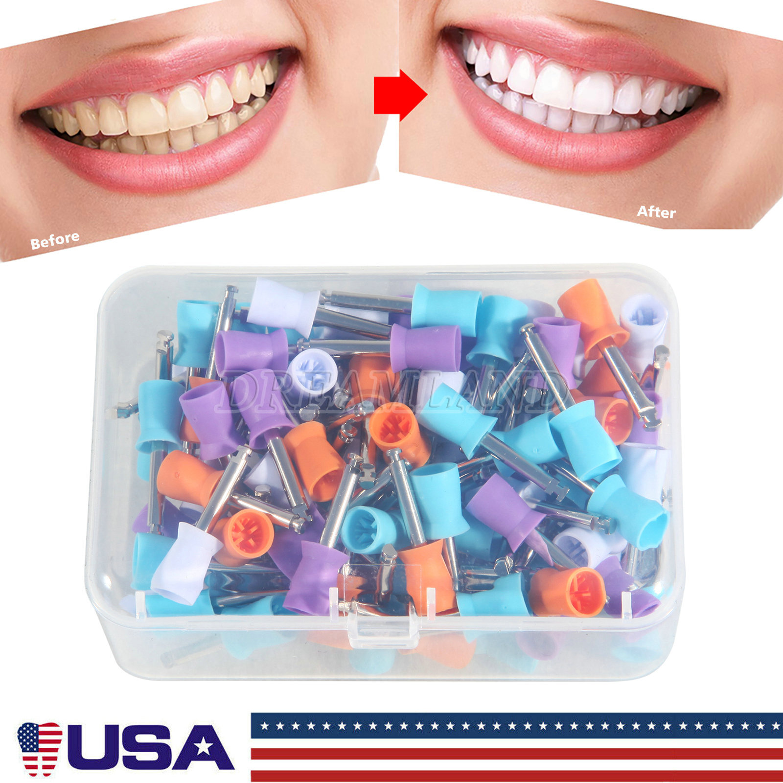 Disposable Dental Prophy Polishing Cups Latch Type Rainbow & White