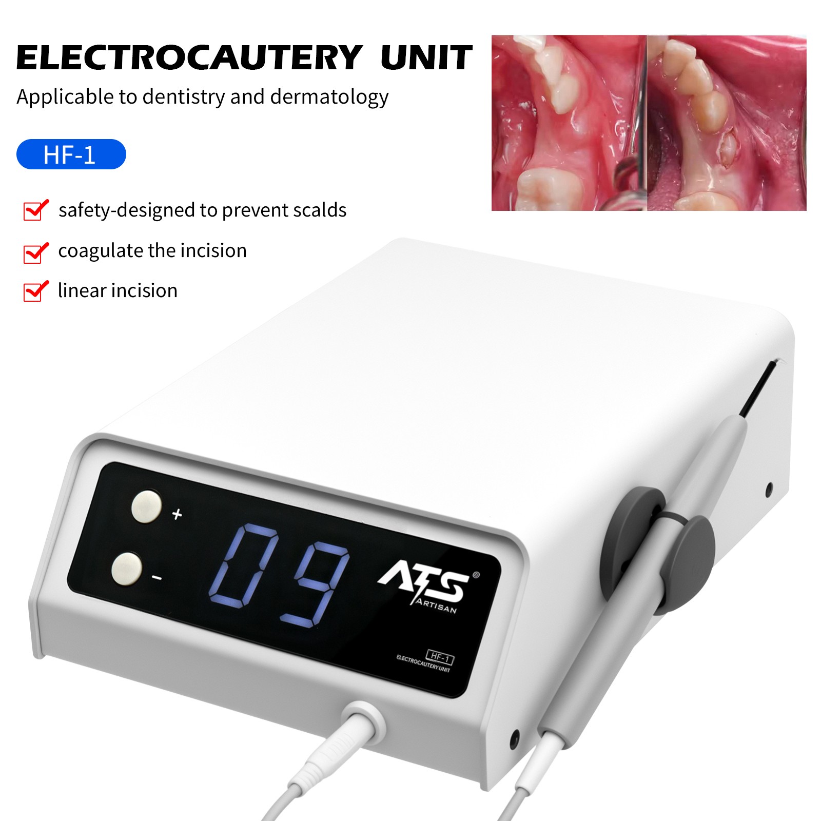 Dental Electrosurge Electrosurgery Unit for Cutting + Coagulating 10 Tips USA