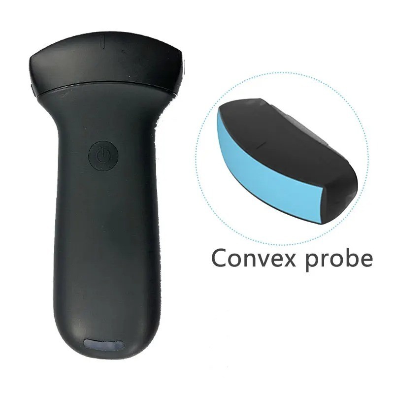 Wireless Ultrasound, Swappable Linear/Convex Probes, Palm Color Doppler Scanner
