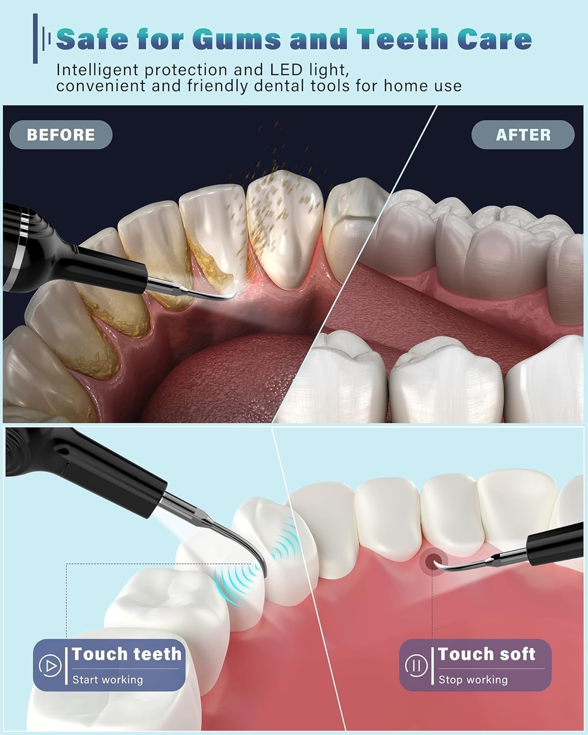Wireless Plaque Remover for Teeth