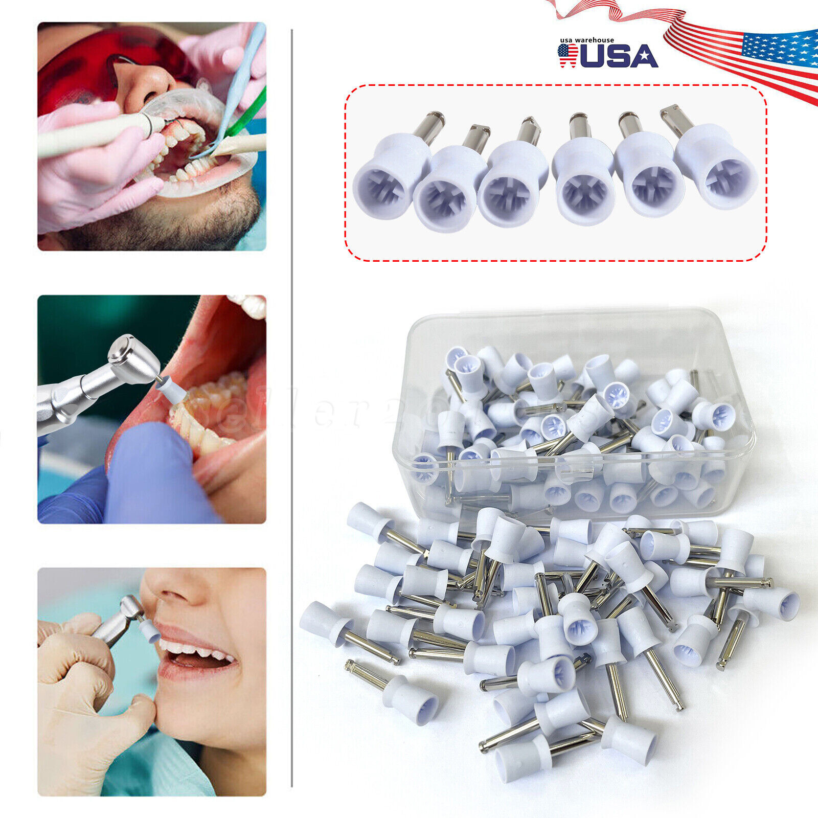 100pcs Dental Tooth Prophy Polishing Cups Latch Type Rubber Polish Polisher US
