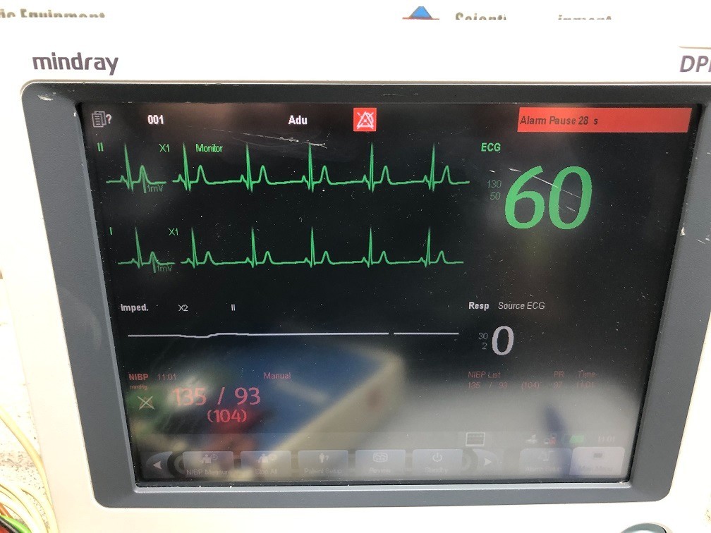 Mindray DPM6 Patient Monitor