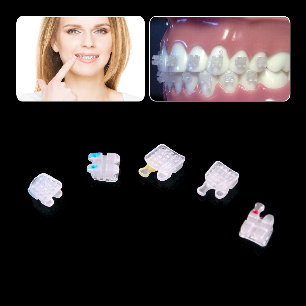 AZDENT Dental Orthodontic Ceramic Clear Brackets Braces MBT/Roth.022 Hooks 3 4 5
