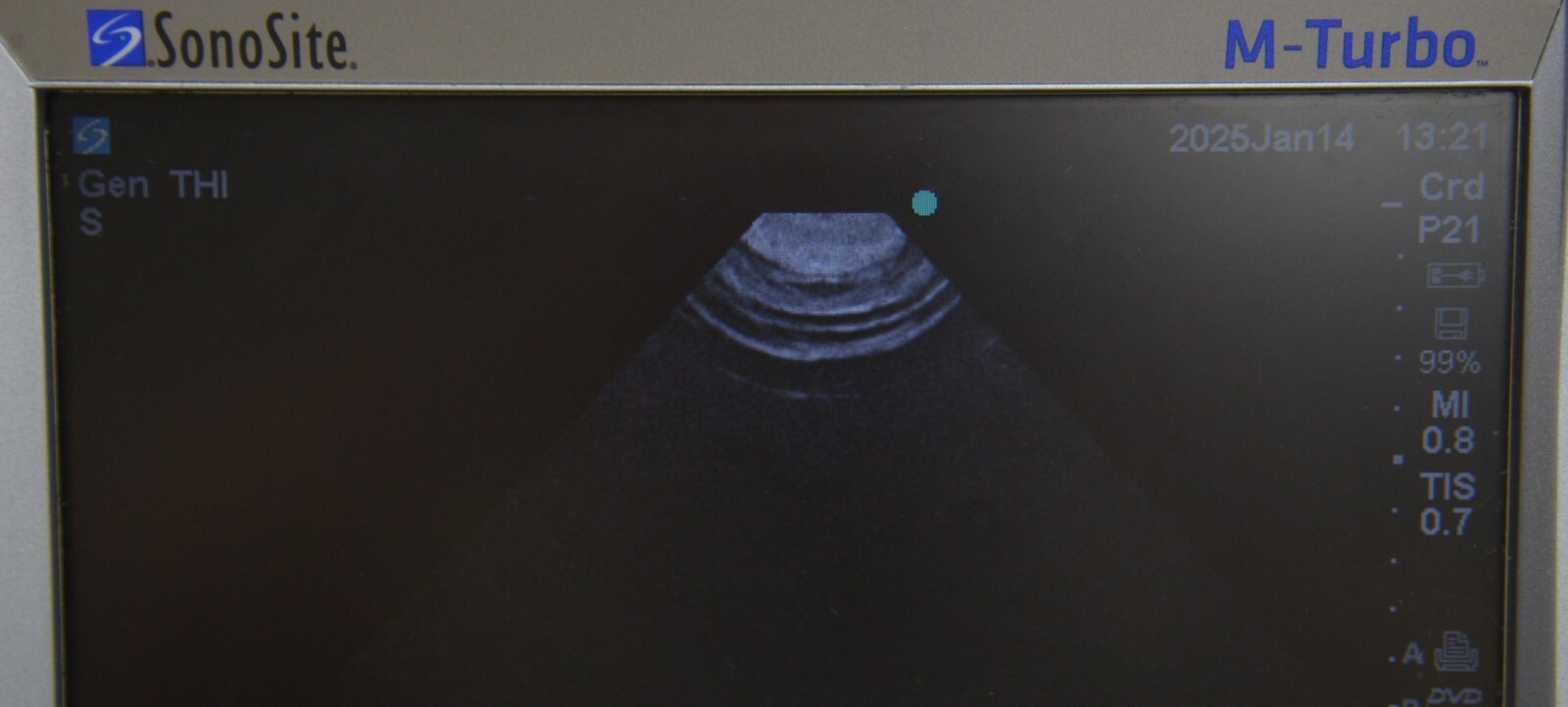 FujiFilm Sonosite P21x/5-1 MHz P07698-21