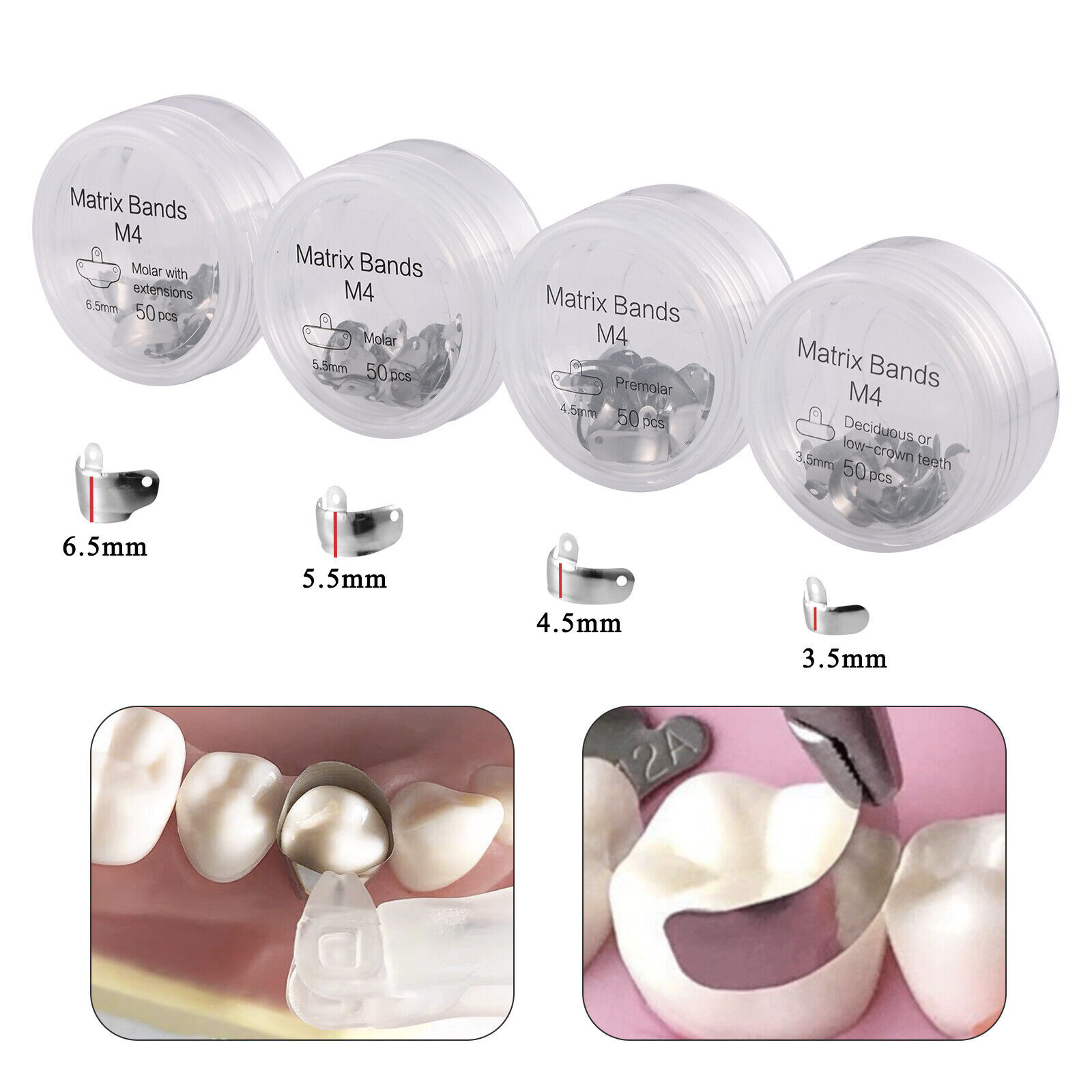 50 Pcs Dental Matrix Bands Palodent V3 Style Sectional Contoured Matrices Refill