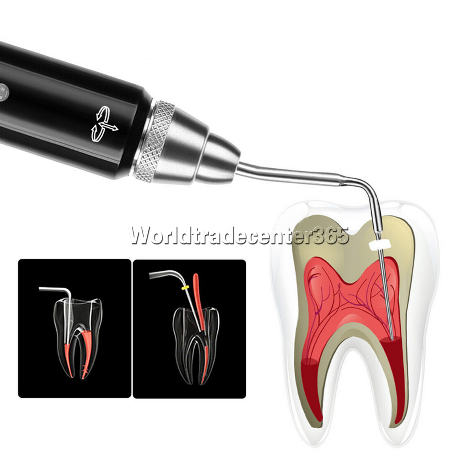 Dental Obturation Pen ENDO Heated System/Gutta Percha Points /Tooth Gum Gutter