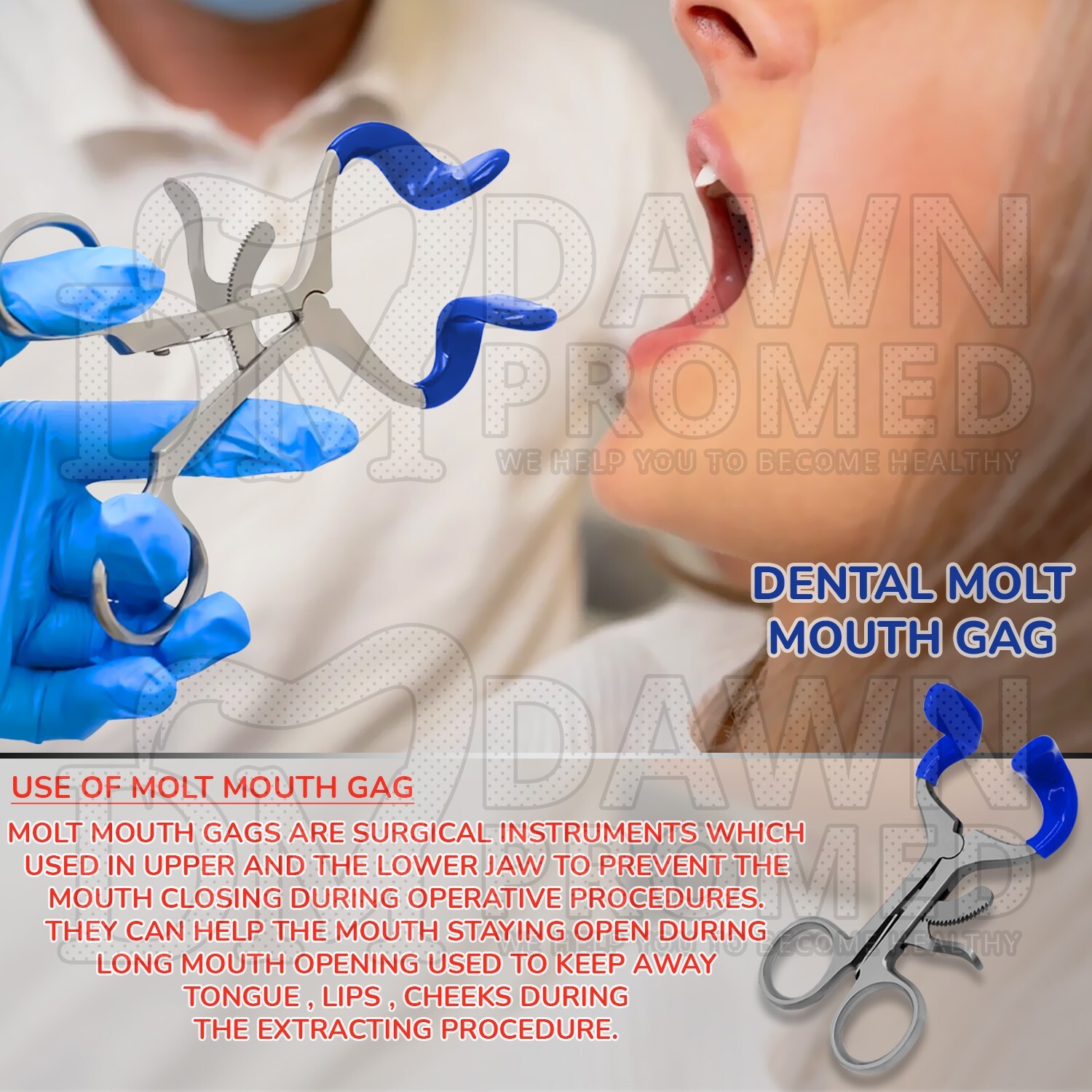 Molt Mouth Gag 3.5″ Blue PVC Mouth Opener Dental Oral & Maxillofacial Instrument