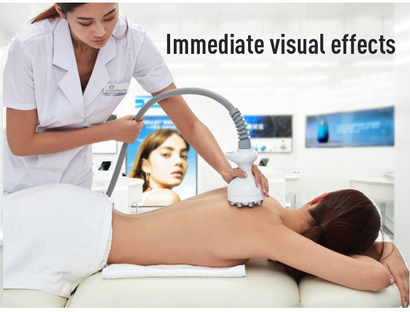Venus Concept Venus Legacy Radiofrequency Cart-Mounted Skin Tightening